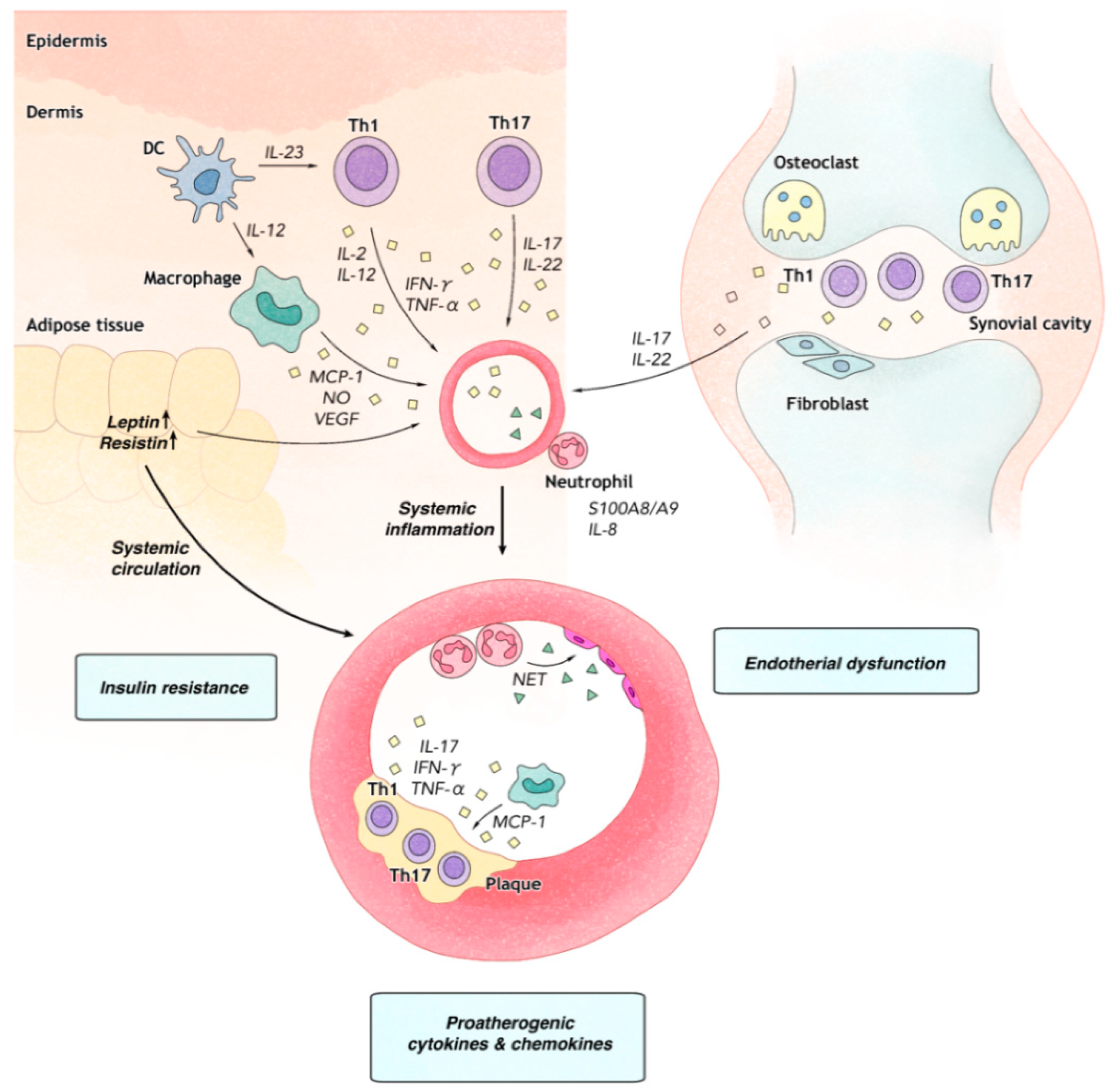 atherosclerosis psoriasis