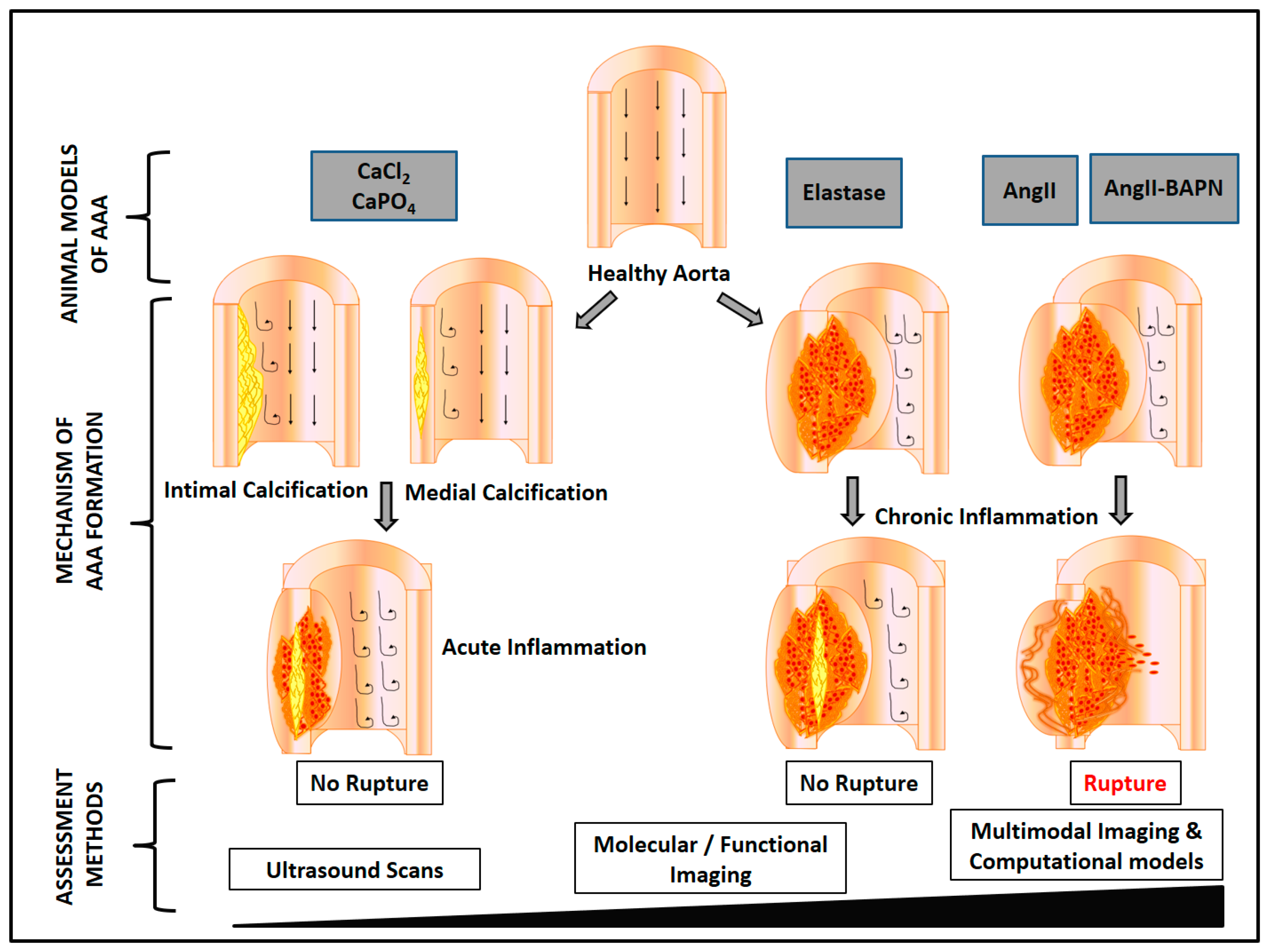 abdominal aortic aneurysm resection priority assessment