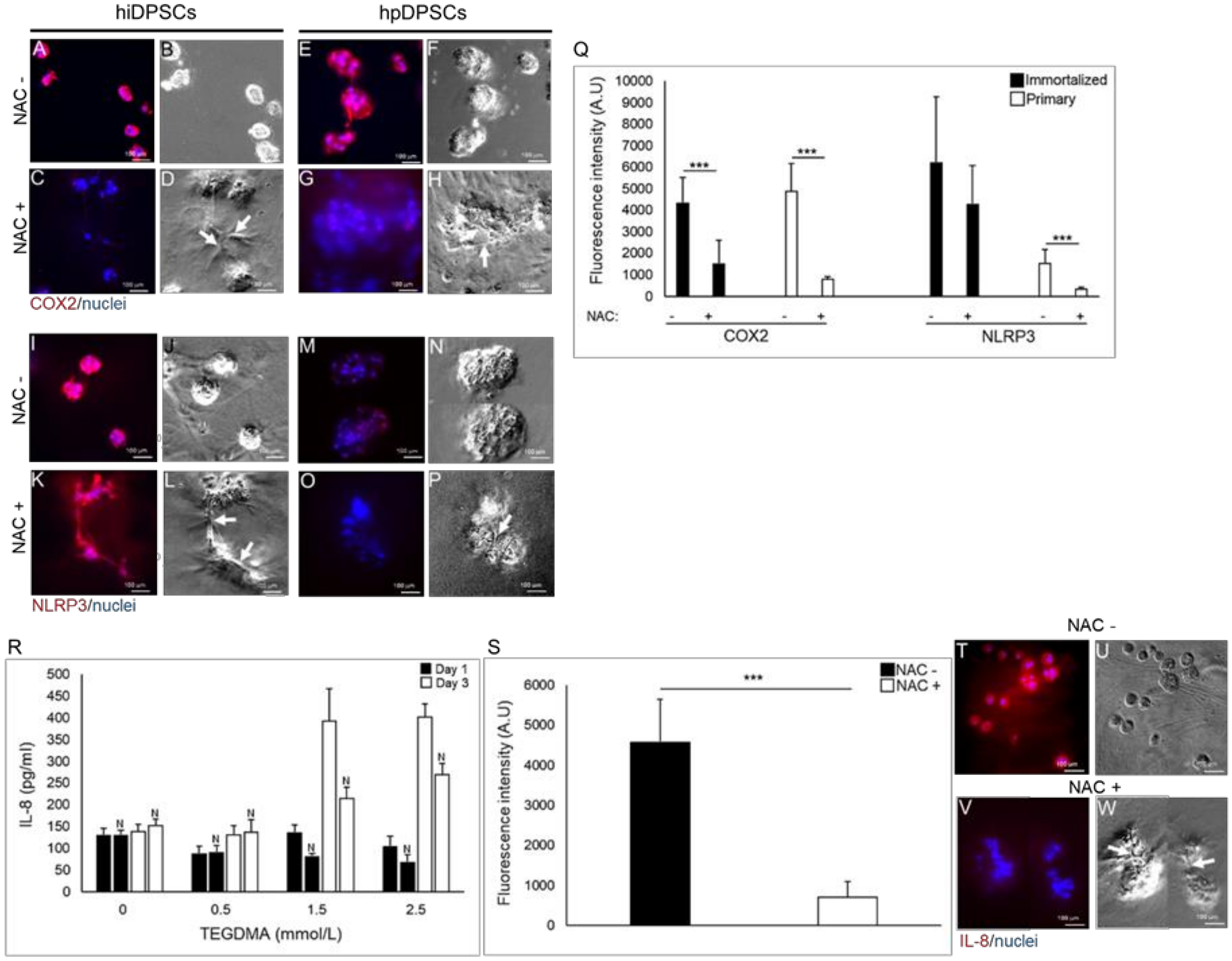 Ijms Free Full Text N Acetyl Cysteine Modulates The Inflammatory And Oxidative Stress Responses Of Rescued Growth Arrested Dental Pulp Microtissues Exposed To Tegdma In Ecm