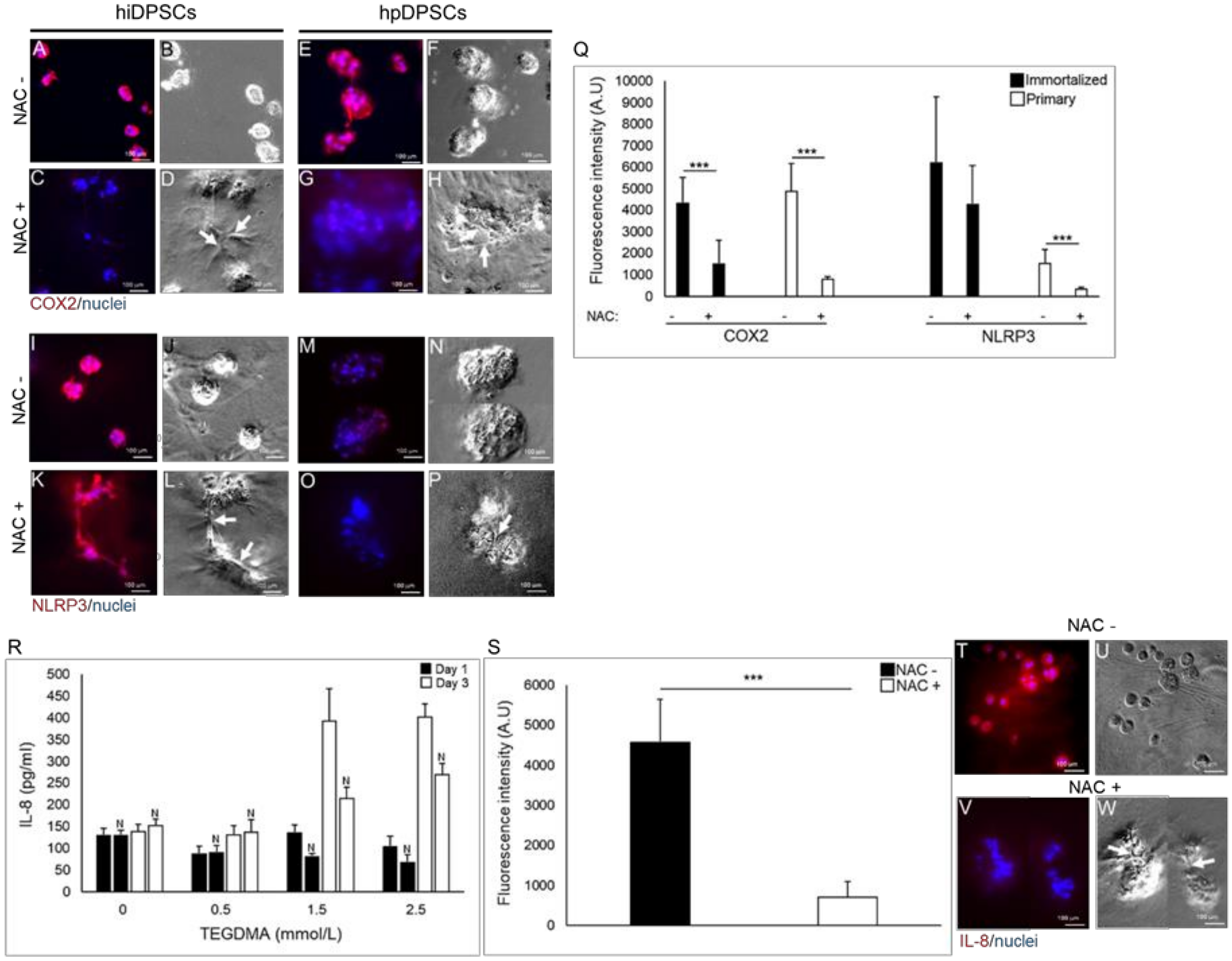 Ijms Free Full Text N Acetyl Cysteine Modulates The Inflammatory And Oxidative Stress Responses Of Rescued Growth Arrested Dental Pulp Microtissues Exposed To Tegdma In Ecm Html