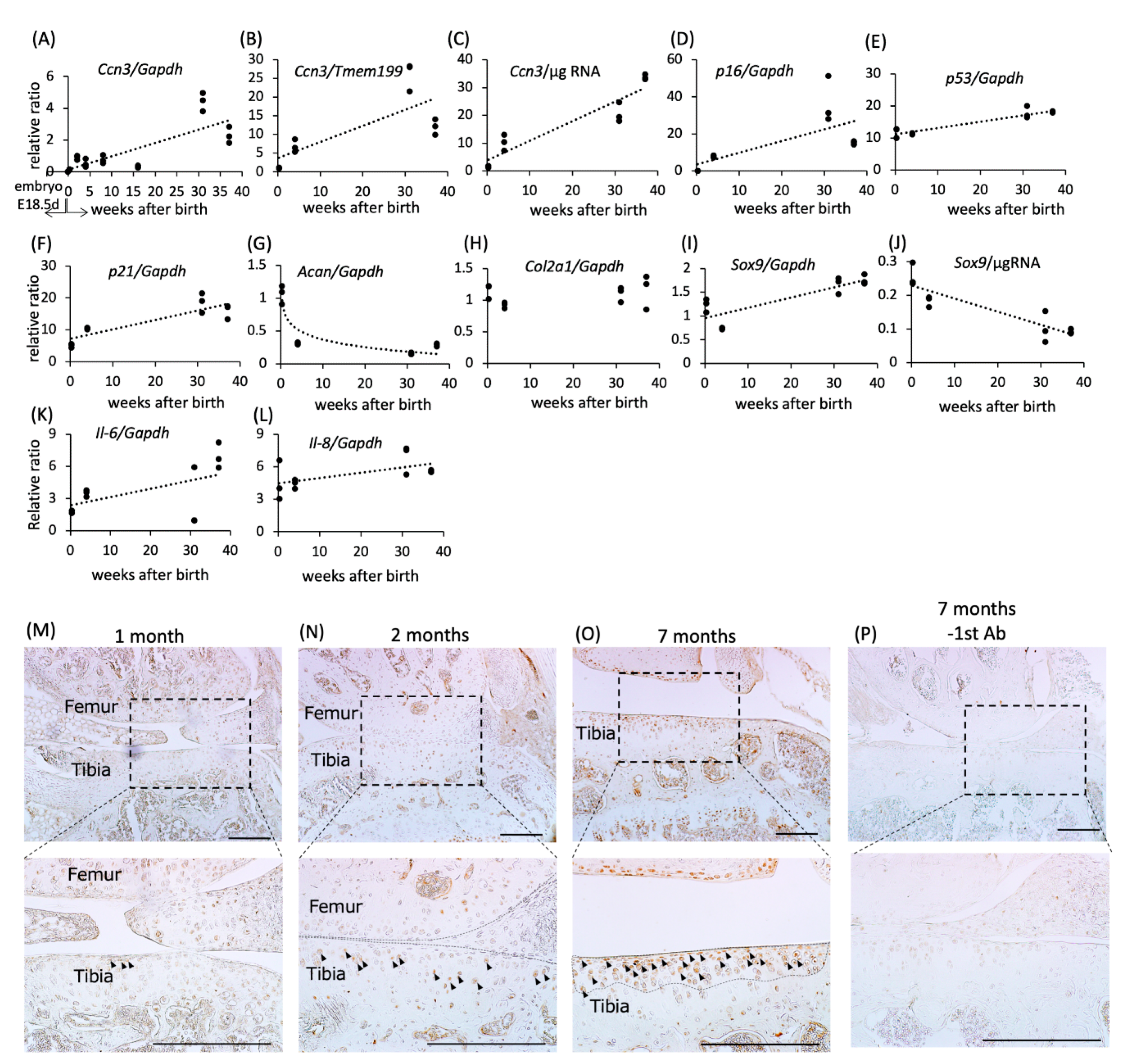 Ijms Free Full Text Ccn3 Nov Drives Degradative Changes In Aging Articular Cartilage