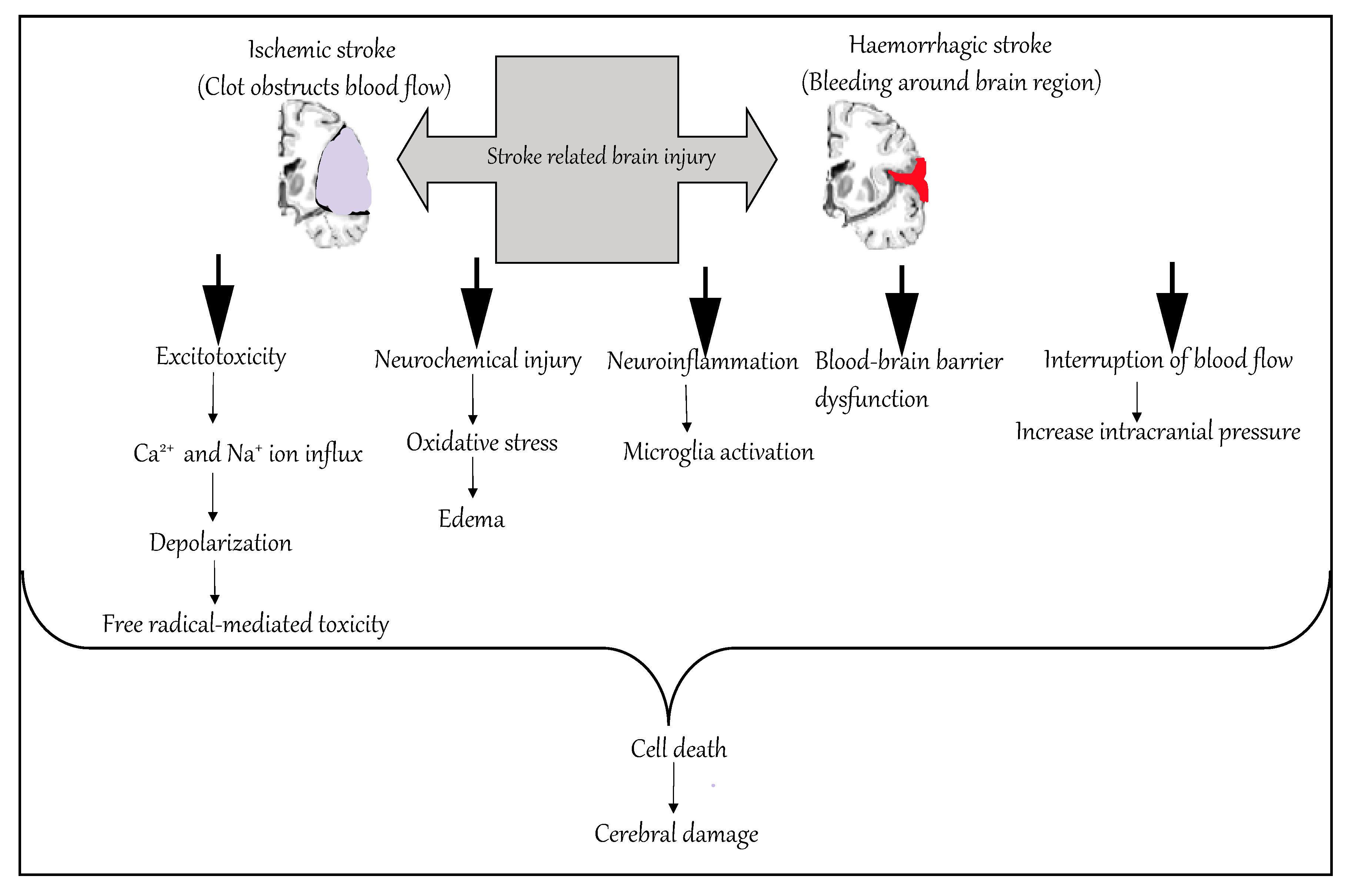 ischemic stroke pathophysiology