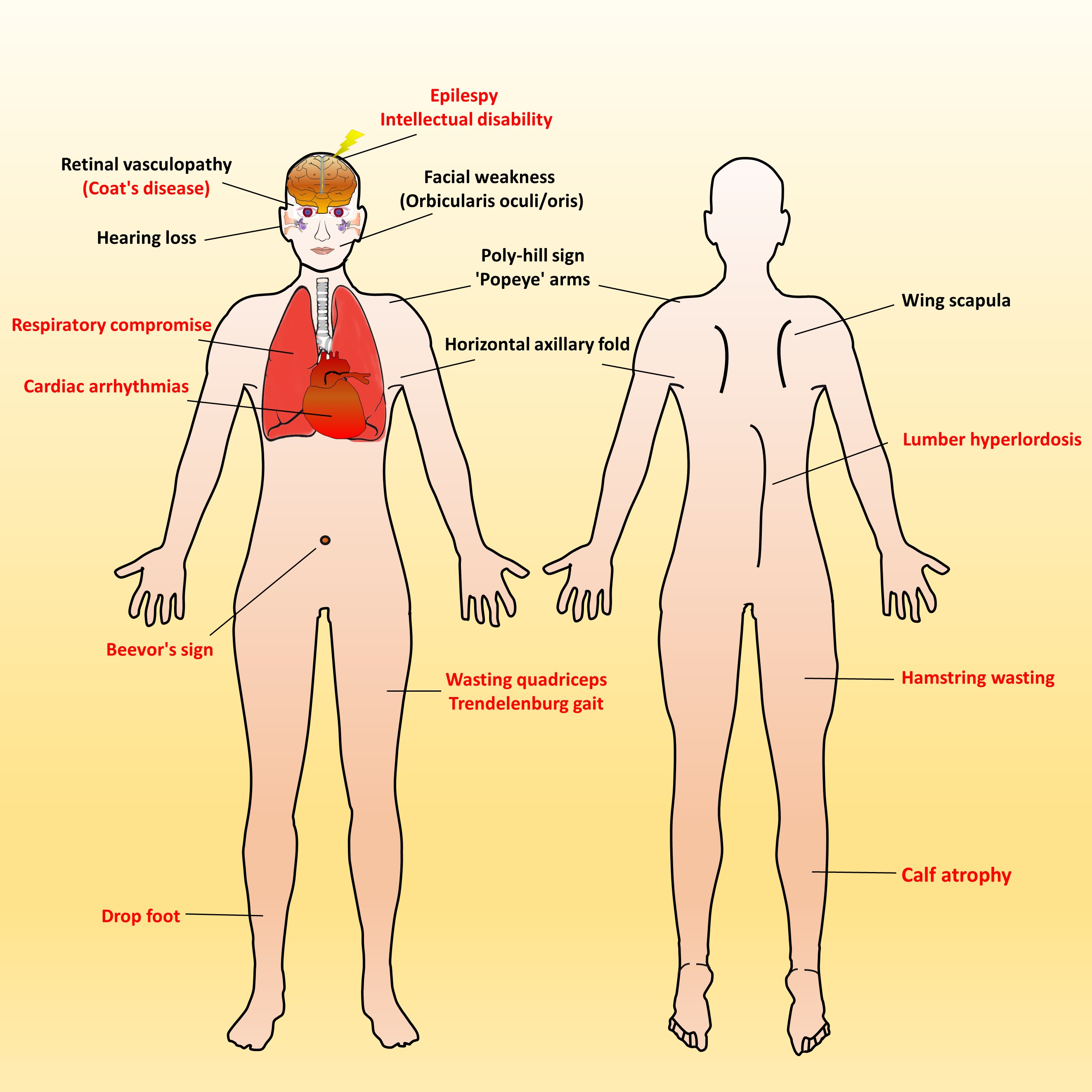 I. Identify The Main Muscles Of The Body, Using The Accompanying Diagram; Indicate, Using The Letters Provided, Where Each Muscle Group Is On The Diagram. / I. Identify The Main Muscles Of The Body, Using The ... : A uses relationship from base use case to child use case indicates that an instance of the base use case.