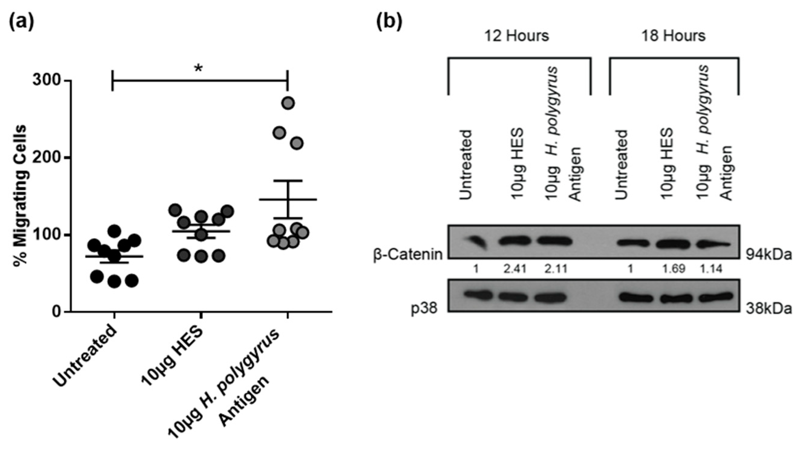 Ijms Free Full Text Gastrointestinal Nematode Derived Antigens Alter Colorectal Cancer Cell Proliferation And Migration Through Regulation Of Cell Cycle And Epithelial Mesenchymal Transition Proteins Html