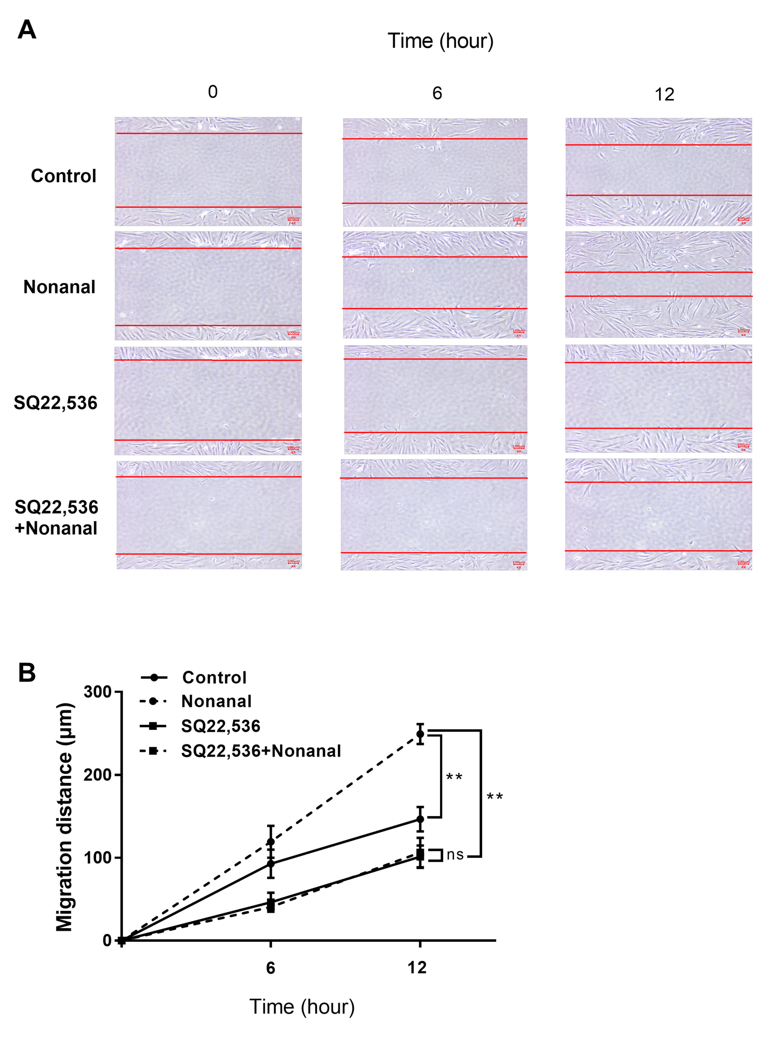 Ijms Free Full Text Nonanal Stimulates Growth Factors Via Cyclic Adenosine Monophosphate Camp Signaling In Human Hair Follicle Dermal Papilla Cells Html