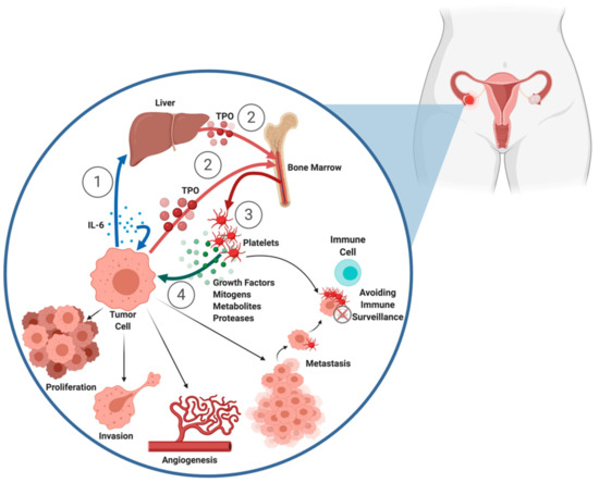 Ijms | Free Full-Text | Platelets, Thrombocytosis, And Ovarian Cancer  Prognosis: Surveying The Landscape Of The Literature | Html