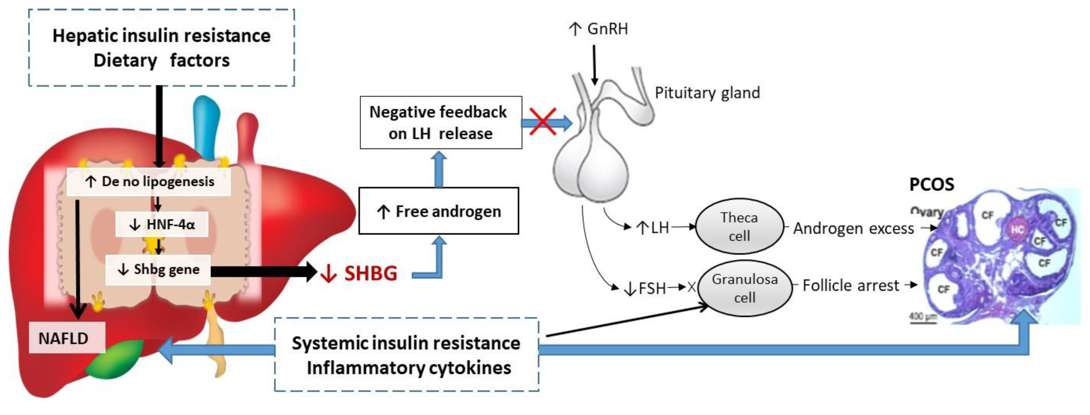 Ijms Free Full Text Sex Hormone Binding Globulin Shbg As An Early 