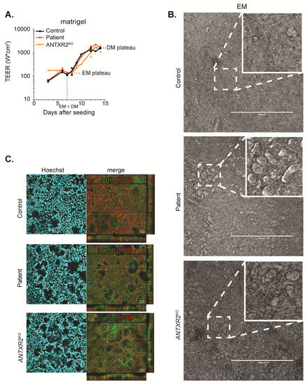 Enhanced Collagen Deposition in the Duodenum of Patients with