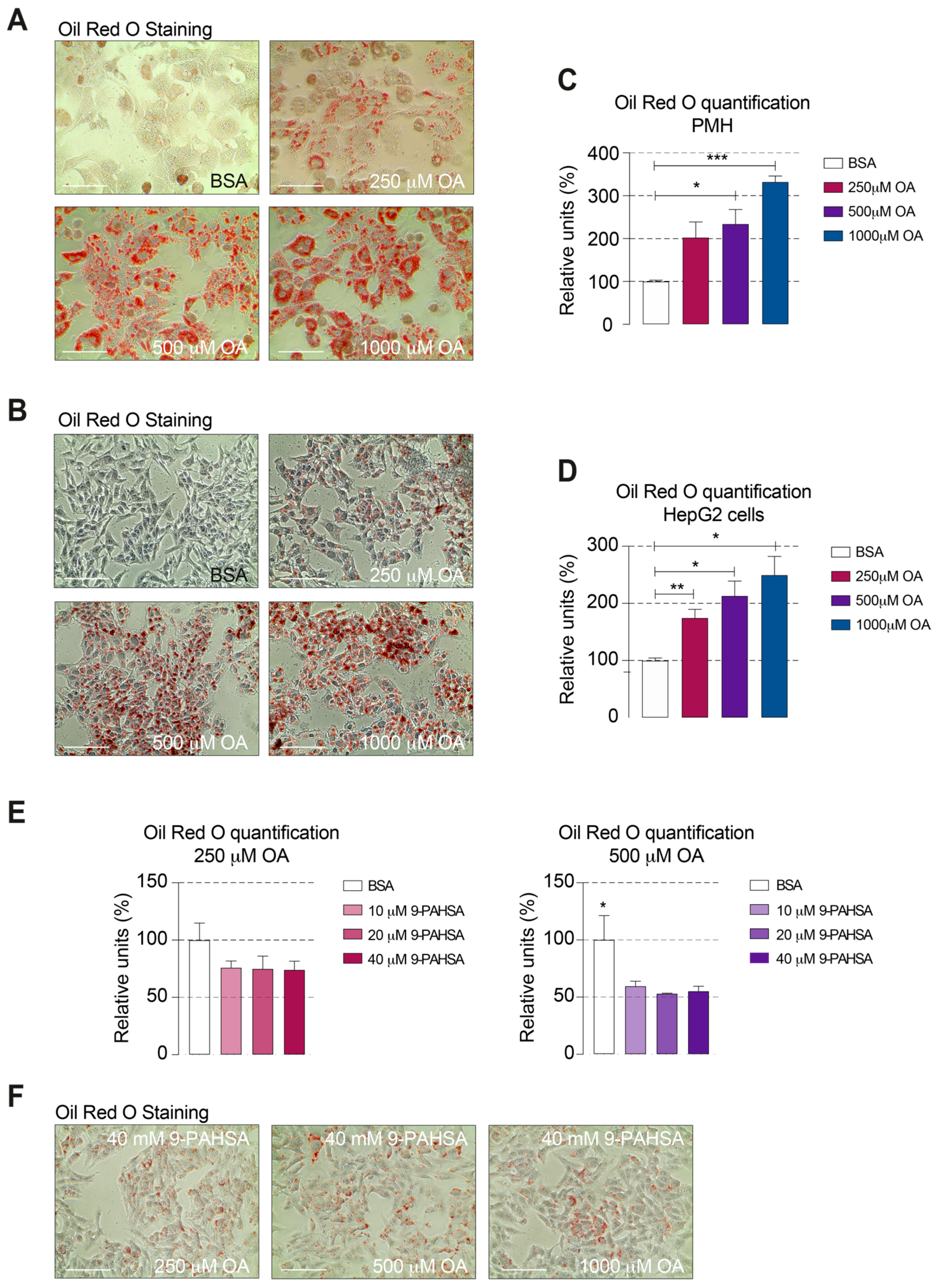 Ijms Free Full Text 9 Pahsa Prevents Mitochondrial Dysfunction And Increases The Viability Of Steatotic Hepatocytes Html