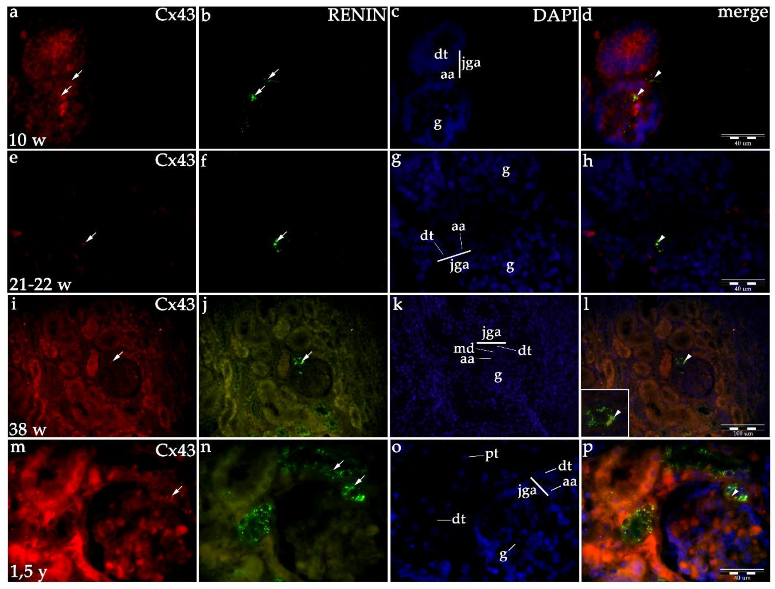 Ijms 21 08349 g003 Ijms 21 08349 g003