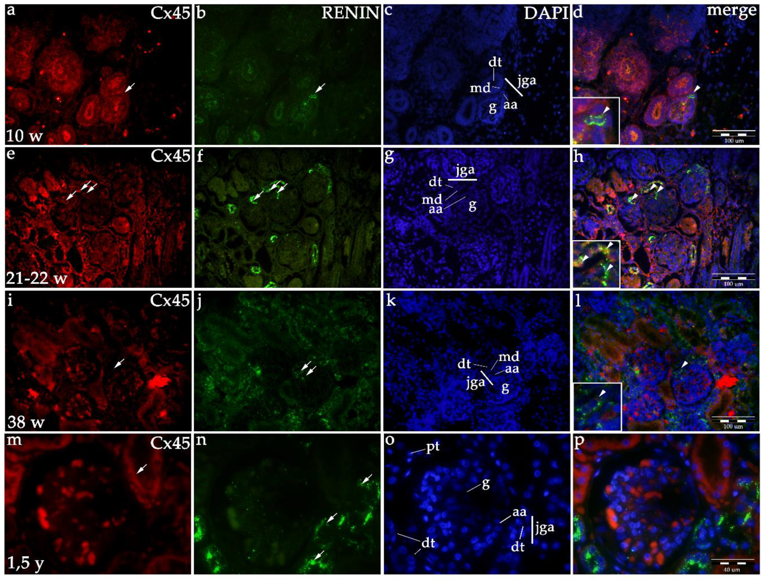 Ijms 21 08349 g004 Ijms 21 08349 g004