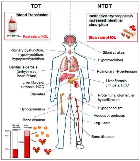 thalassemia essay