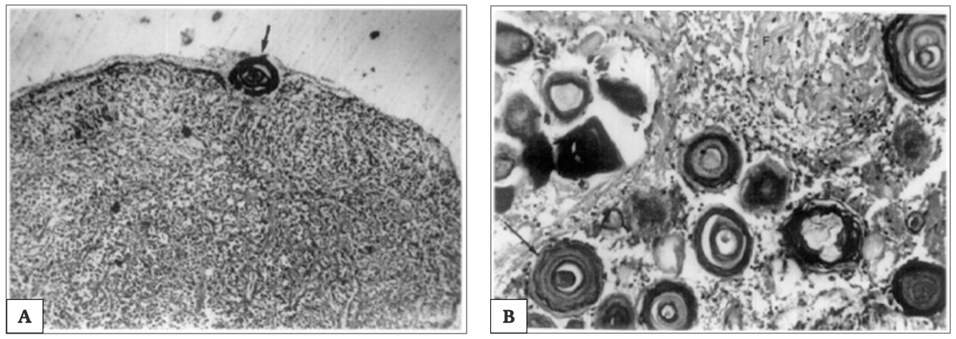 Ijms 21 08806 g007 Ijms 21 08806 g007