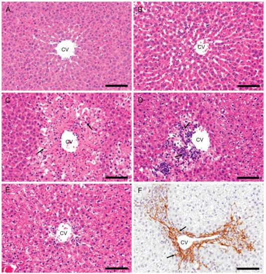 IJMS Free FullText AcetaminophenInduced Rat Hepatotoxicity Based on M1/M2Macrophage