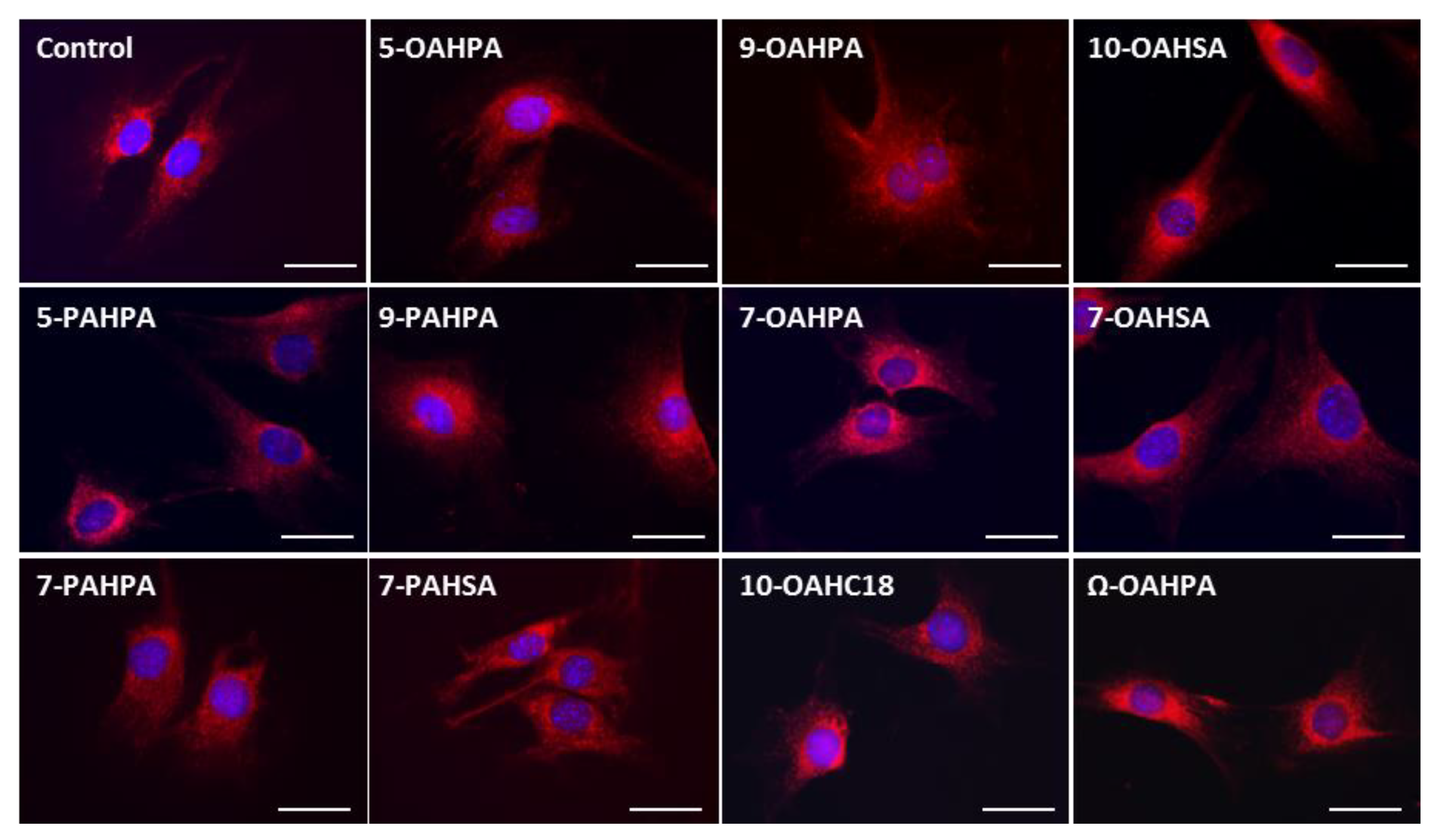 Ijms 21 09046 g004 Ijms 21 09046 g004