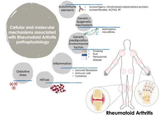 primer rheumatoid arthritis