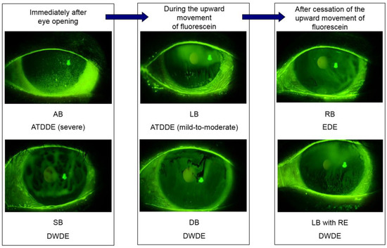 How Tears Work  National Eye Institute