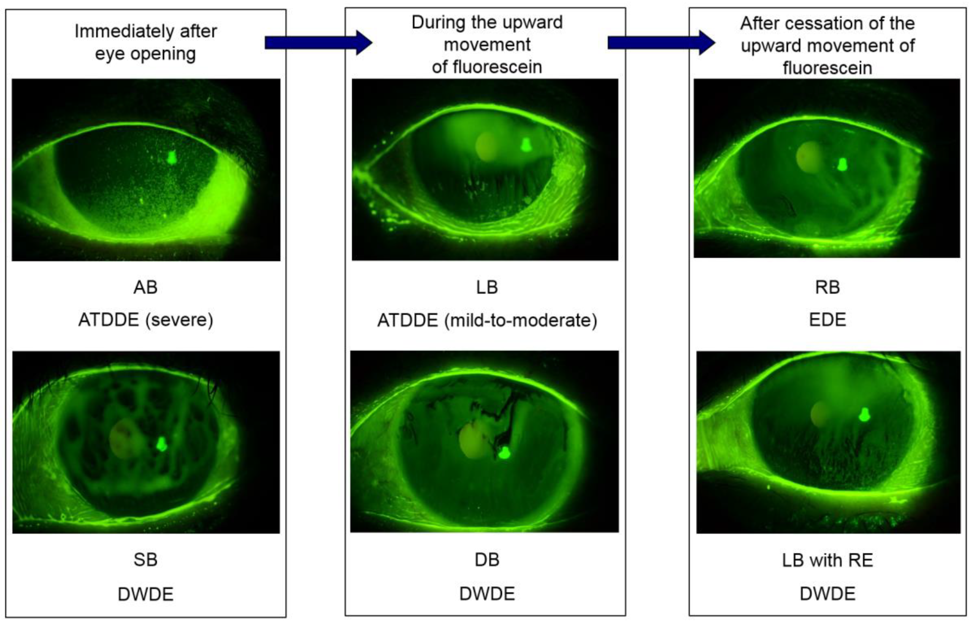 Ijms Free Full Text Defining Dry Eye From A Clinical Perspective Html Ijms Free Full Text Defining Dry Eye From A Clinical Perspective Html