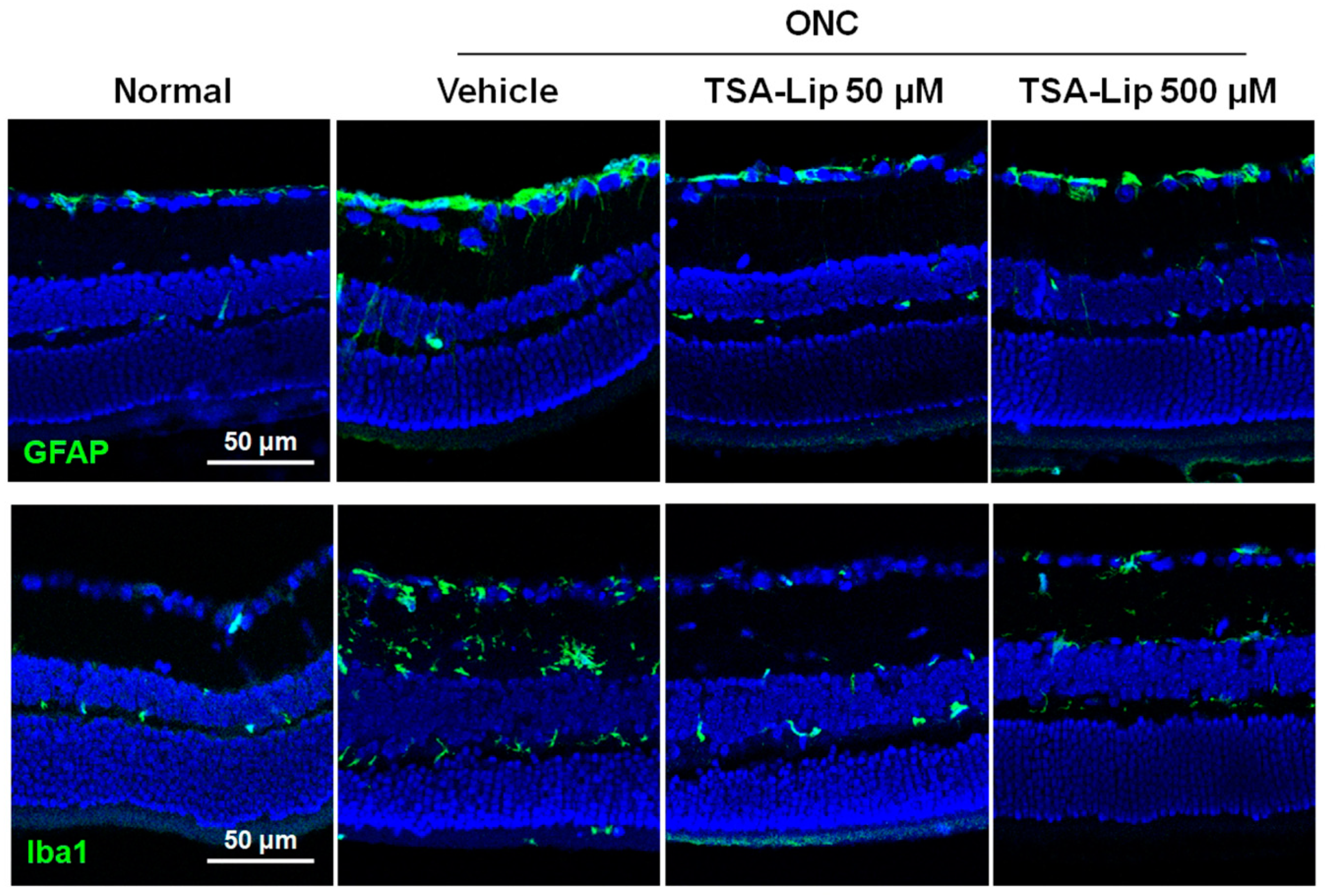 Ijms 21 09297 g006 Ijms 21 09297 g006