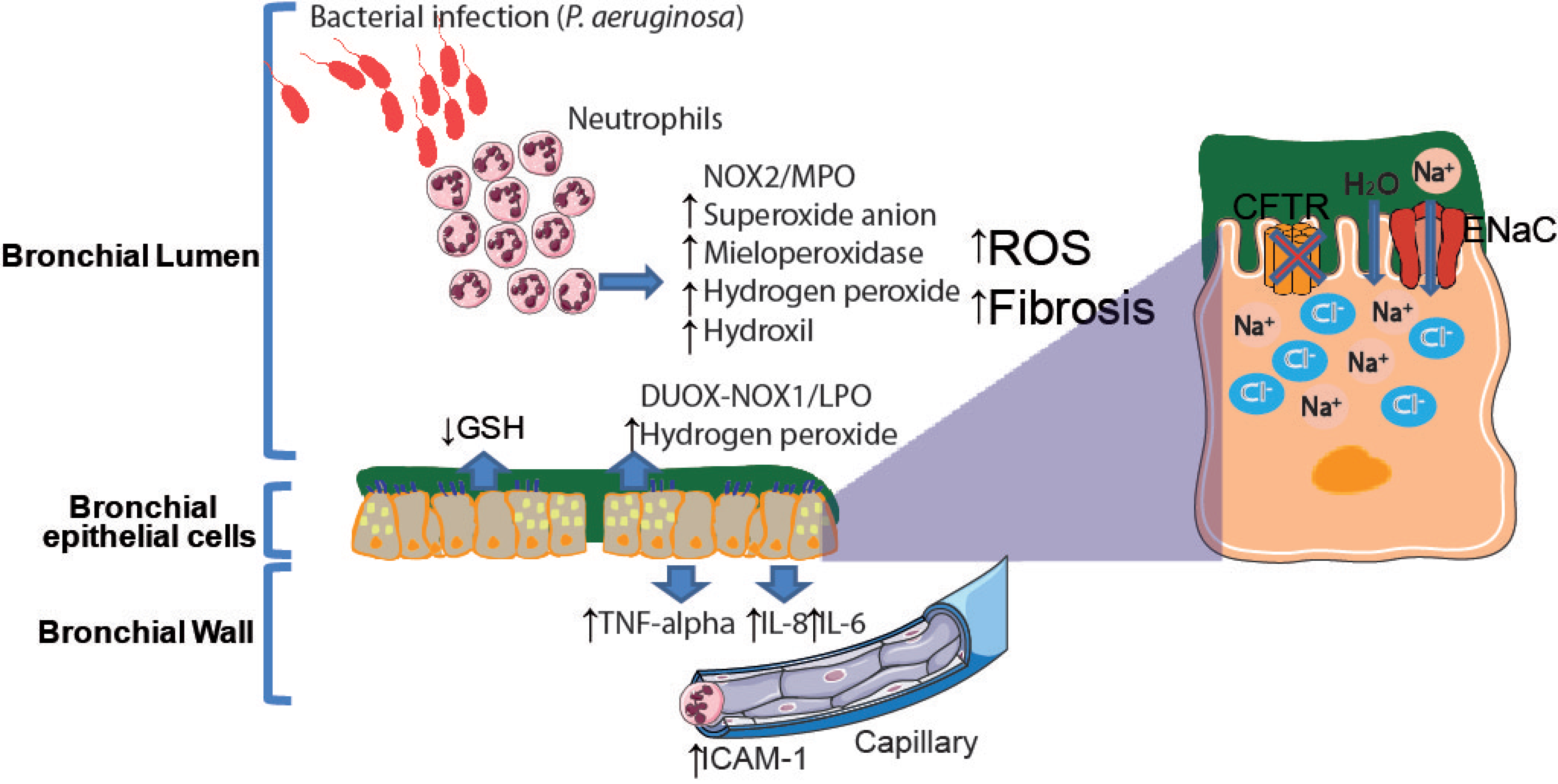 IJMS | Free Full-Text | Airway Redox Homeostasis and Inflammation 