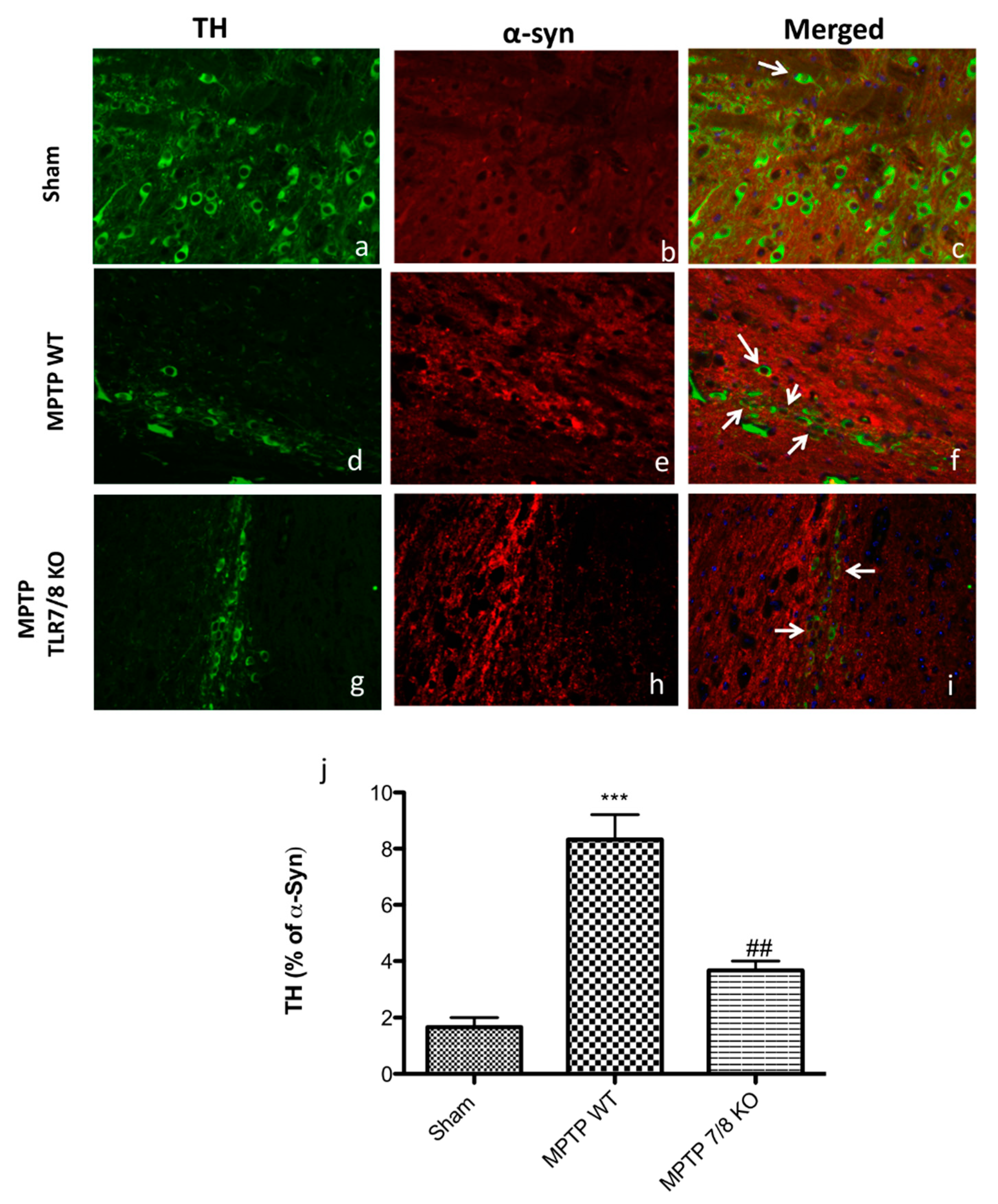 Ijms Free Full Text Tlr7 8 In The Pathogenesis Of Parkinson S Disease Html