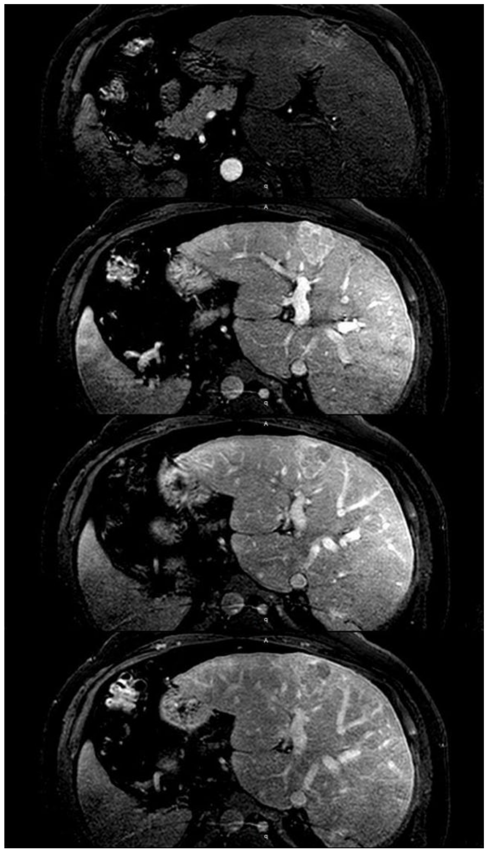 Ijms 21 09420 g004 Ijms 21 09420 g004