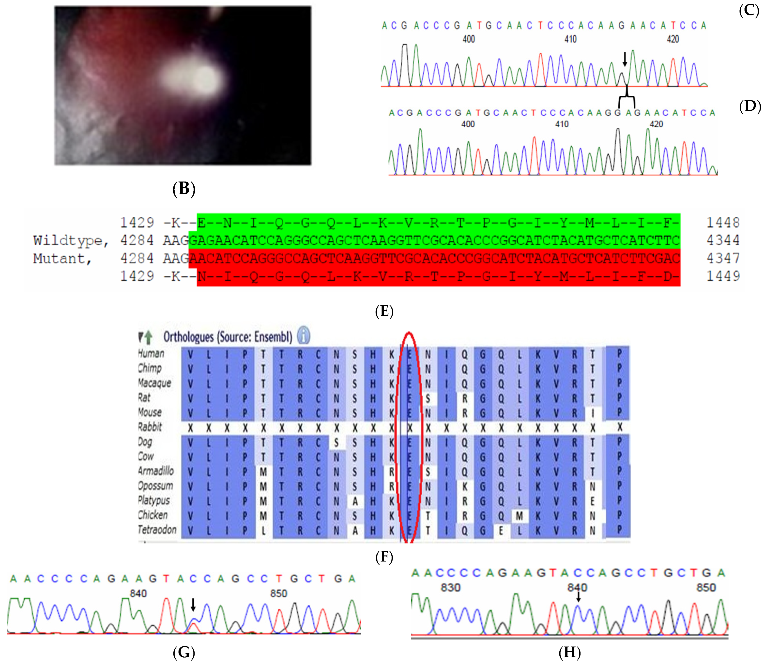 Ijms Free Full Text Application Of Wes Towards Molecular Investigation Of Congenital Cataracts Identification Of Novel Alleles And Genes In A Hospital Based Cohort Of South India Html