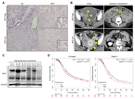 Ijms December 2 2020 Browse Articles