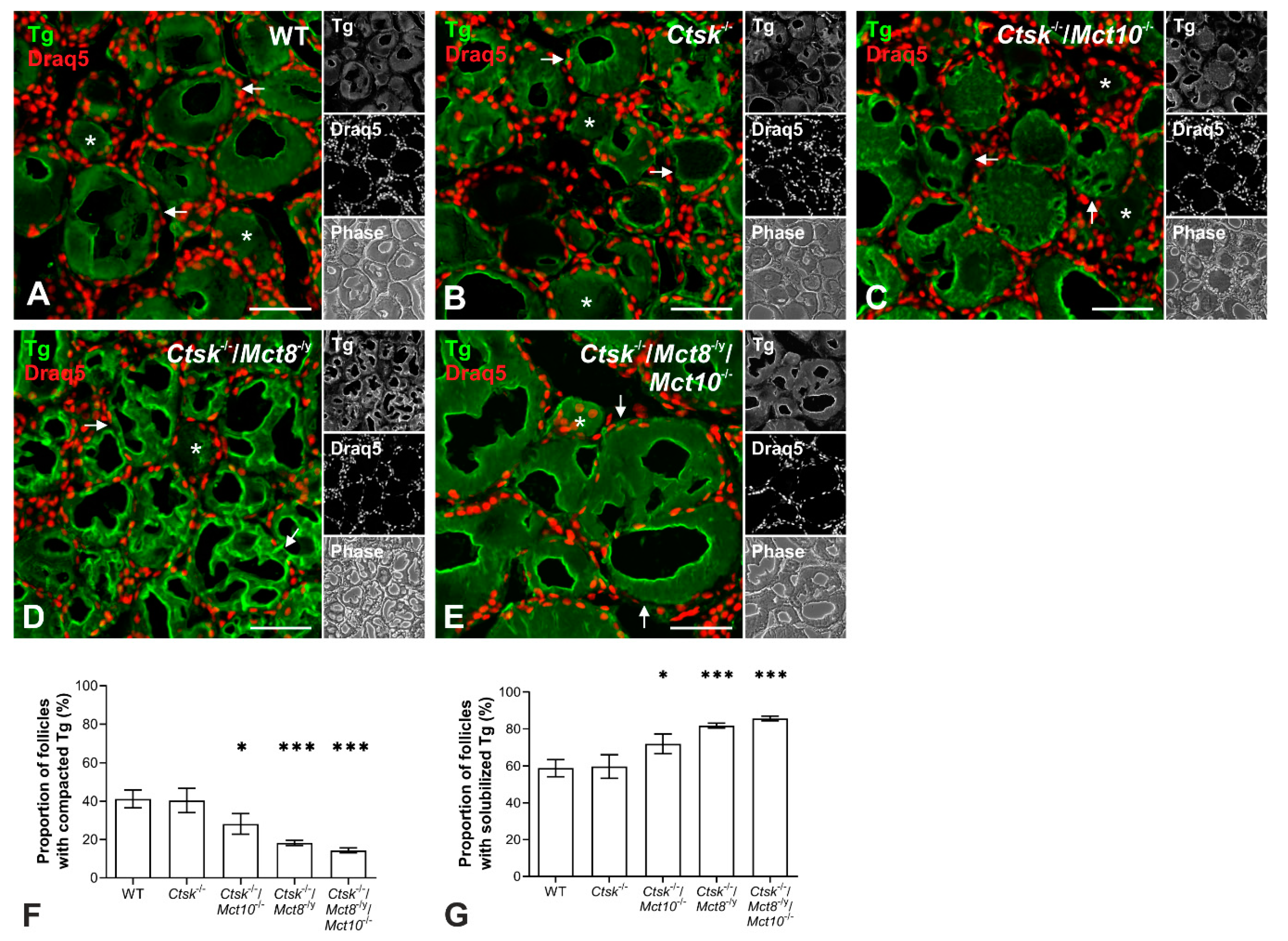 Ijms Free Full Text The Thyroid Hormone Transporter Mct8 Restricts Cathepsin Mediated Thyroglobulin Processing In Male Mice Through Thyroid Auto Regulatory Mechanisms That Encompass Autophagy Html