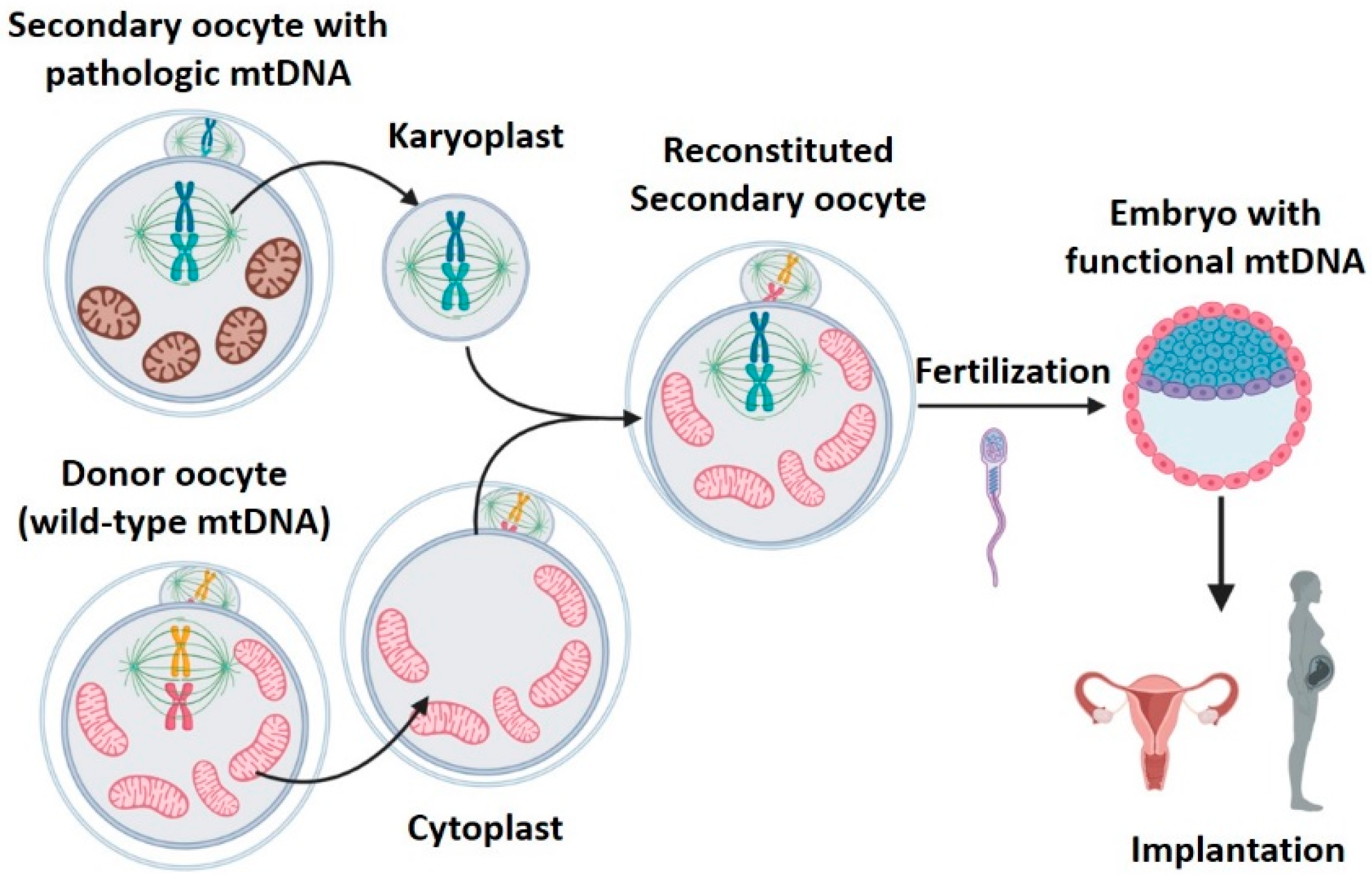IJMS Free FullText Mitochondrial DNA Replacement Techniques to