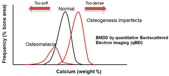 Understanding Osteogenesis Imperfecta: The Fragile Bone Disorder - Preventative measures to reduce risk of fractures