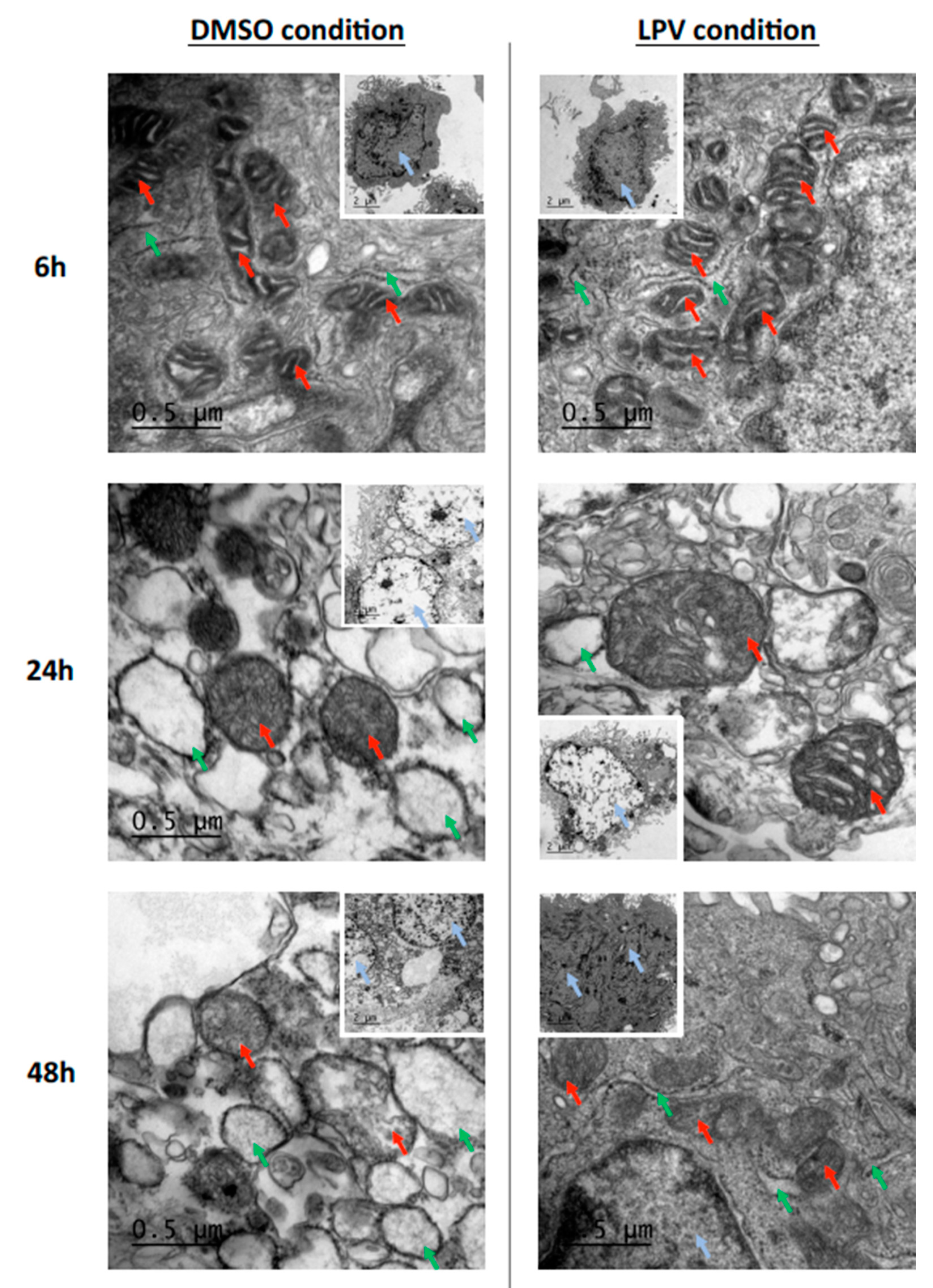 Ijms 22 00683 g005 Ijms 22 00683 g005