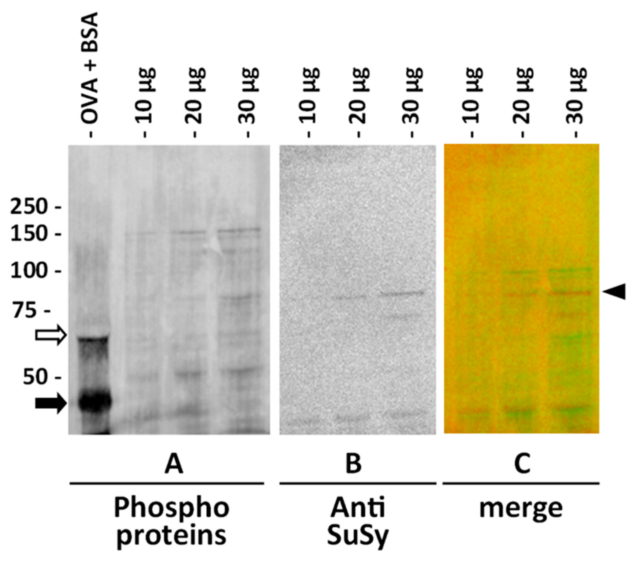 Ijms 22 00851 g006 Ijms 22 00851 g006
