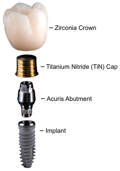 Ijms Free Full Text Marginal Adaptation And Microbial Leakage At Conometric Prosthetic Connections For Implant Supported Single Crowns An In Vitro Investigation Html