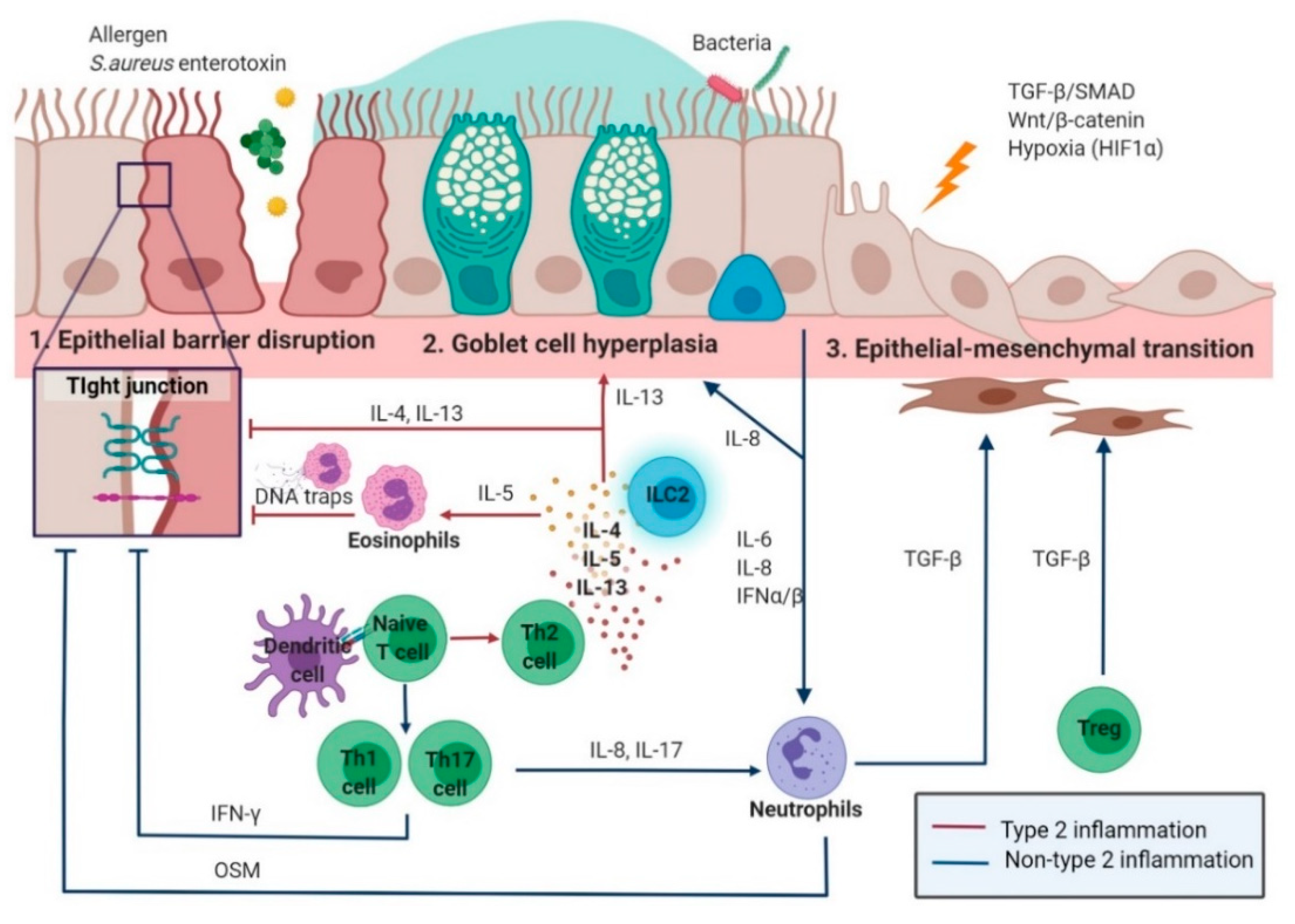 Staphylococcus aureus as a cause of refractory chronic rhinosinusitis