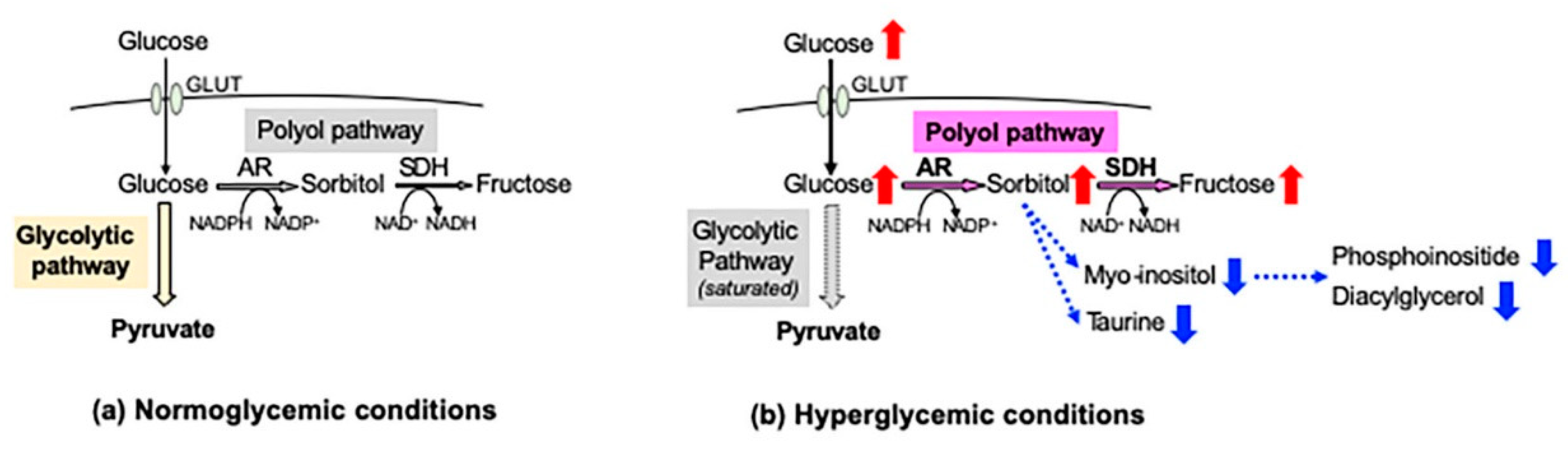 Sorbitol pathway