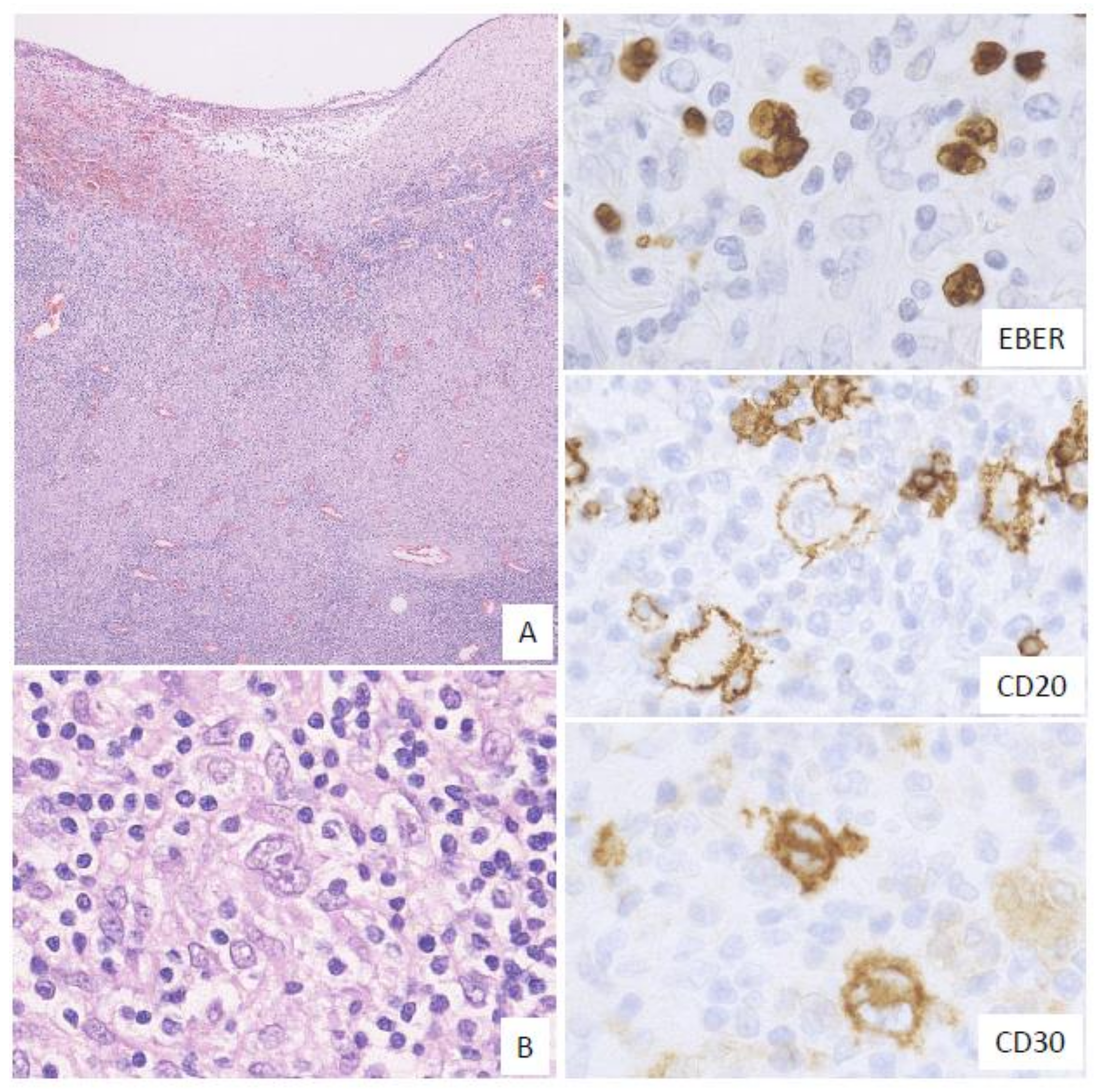 Ijms 22 01053 g004 Ijms 22 01053 g004