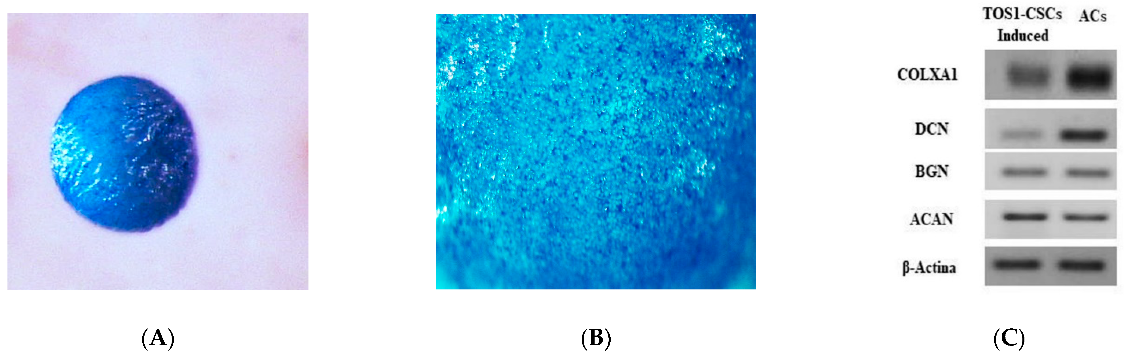 Analysis of a Preliminary microRNA Expression Signature in a