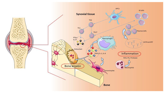 Tocilizumab-Atlizumab Overview - Creative Biolabs Rheumatoid arthritis mechanism