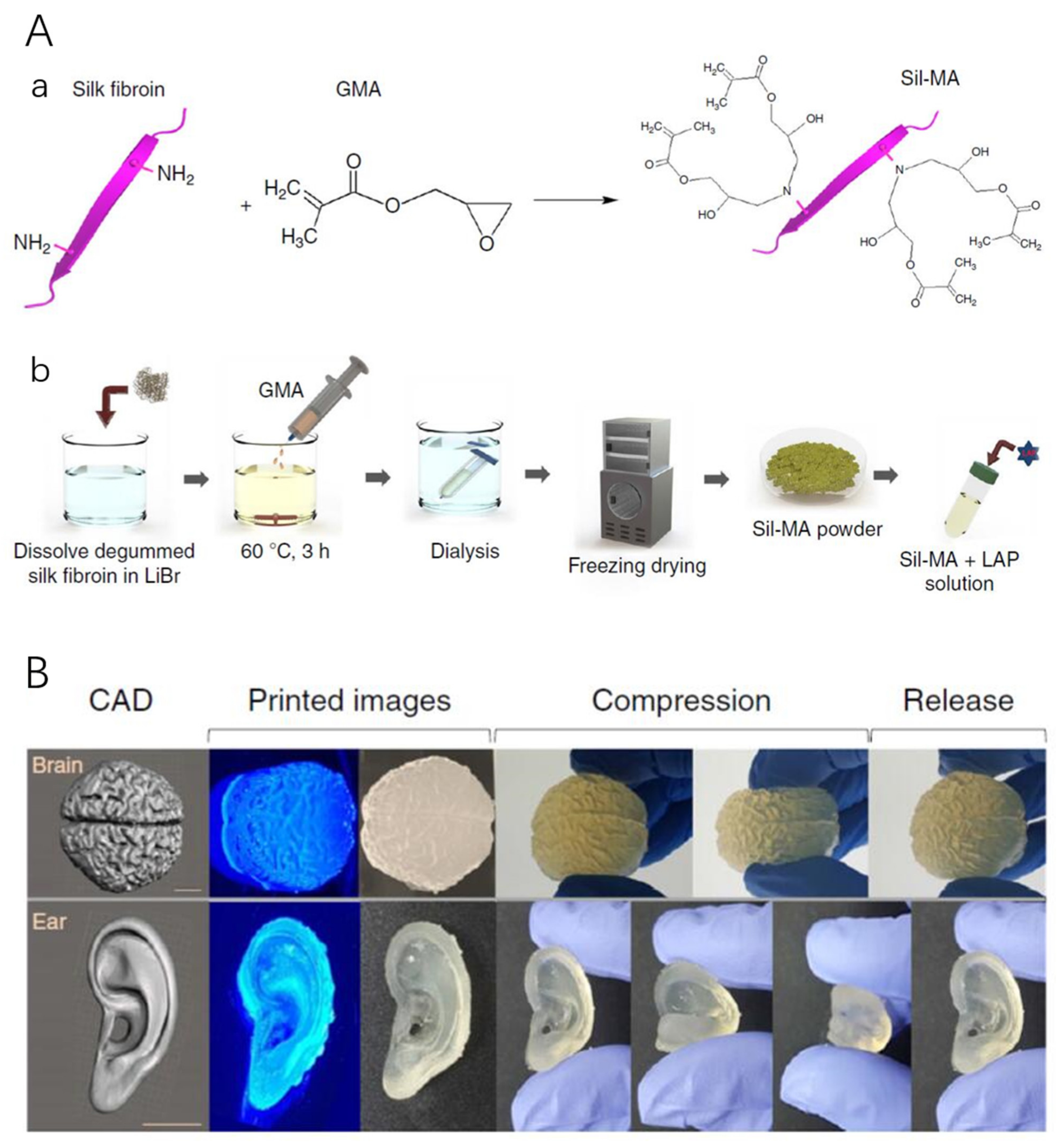 Silk fibroin scaffolds for common cartilage injuries