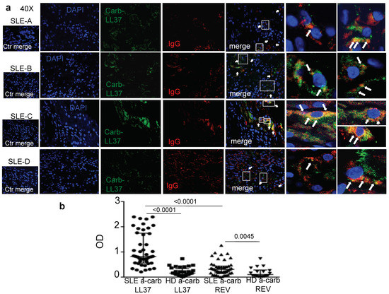 Complementary Effects of Carbamylated and Citrullinated LL37 in