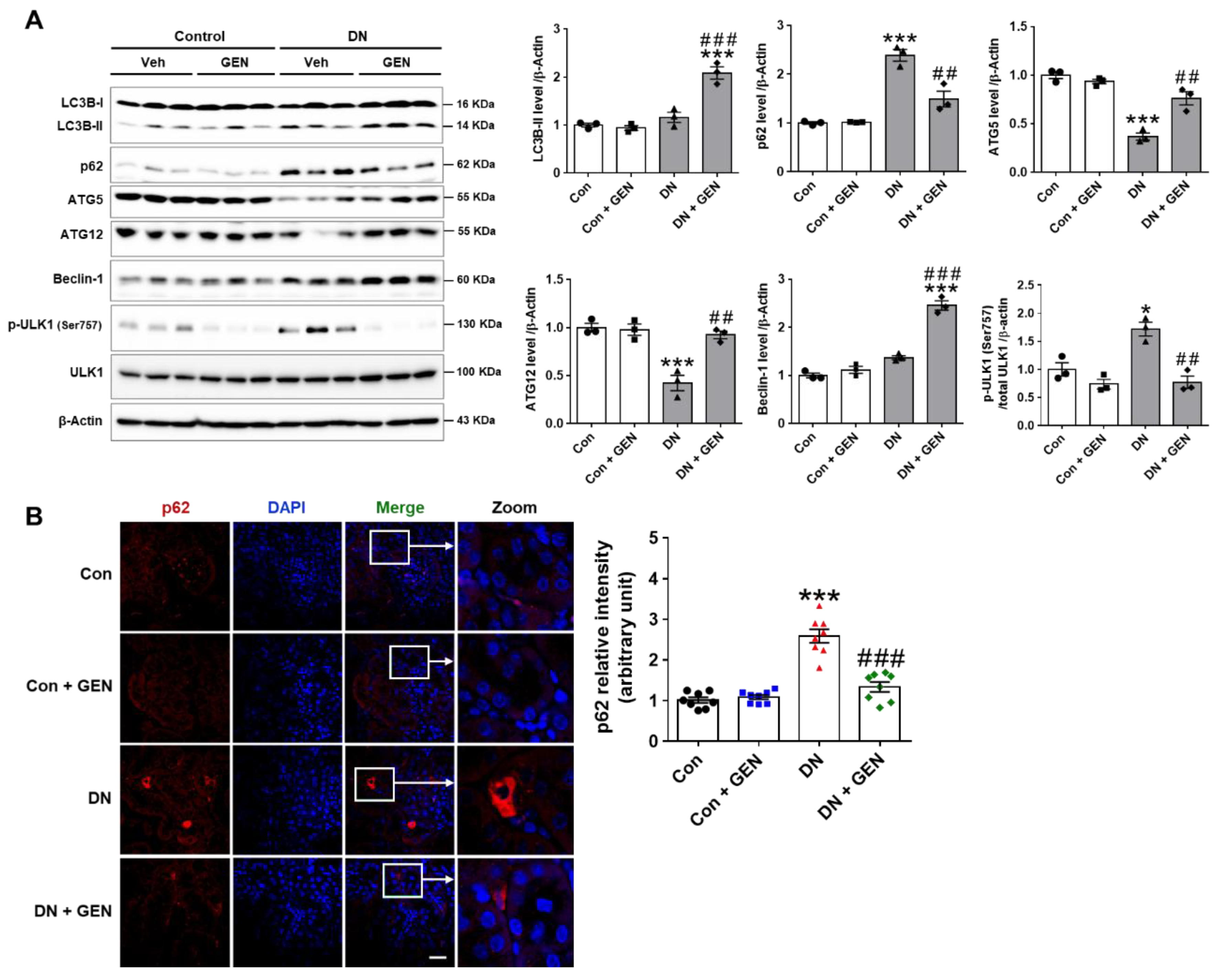 Ijms 22 01651 g005 Ijms 22 01651 g005