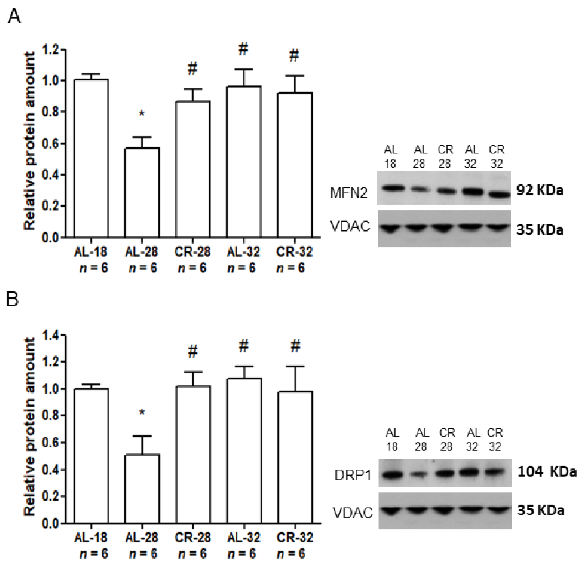 Ijms Free Full Text The Age Sensitive Efficacy Of Calorie Restriction On Mitochondrial Biogenesis And Mtdna Damage In Rat Liver Html Ijms Free Full Text The Age Sensitive Efficacy Of Calorie Restriction On Mitochondrial Biogenesis And Mtdna Damage In Rat Liver Html
