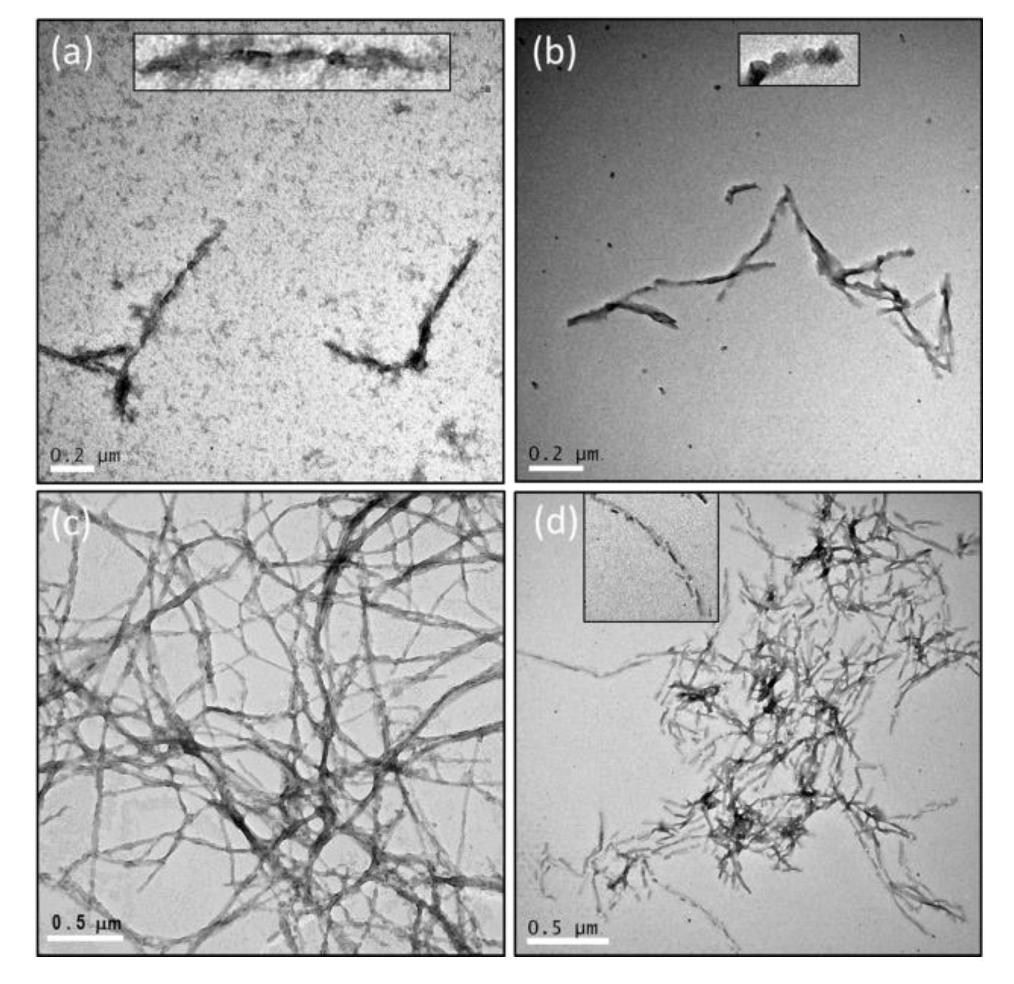 Ijms 22 01800 g005 Ijms 22 01800 g005