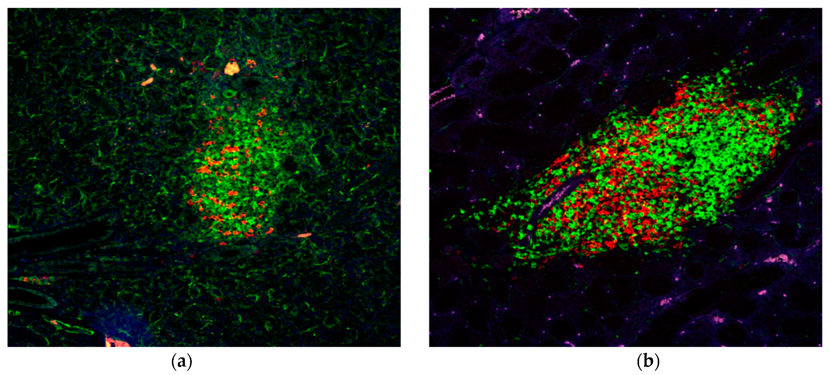 Ijms Free Full Text Early Covert Appearance Of Marginal Zone B Cells In Salivary Glands Of Sjogren S Syndrome Susceptible Mice Initiators Of Subsequent Overt Clinical Disease Html