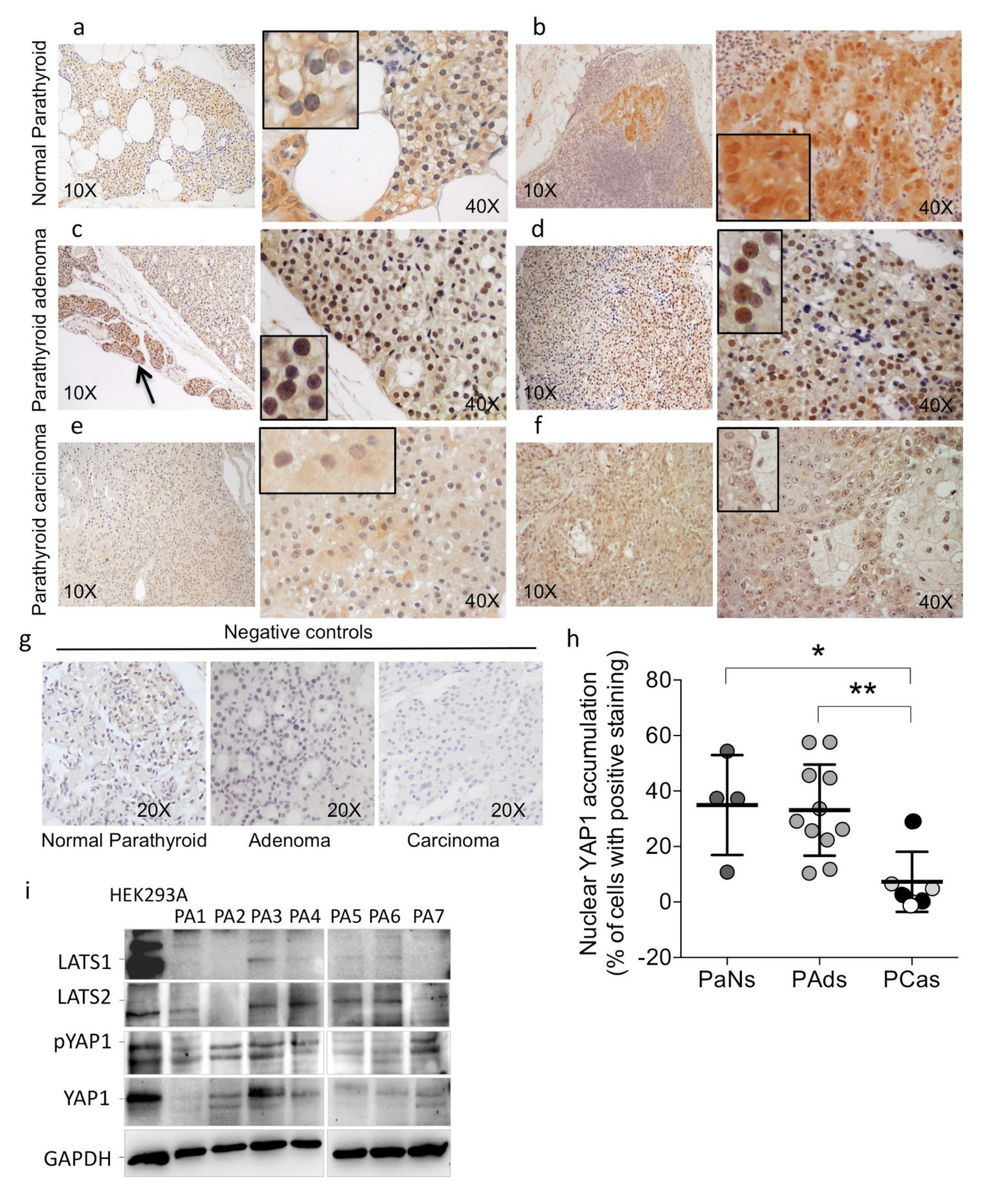 Yes-Associated Protein 1 Is a Novel Calcium Sensing Receptor