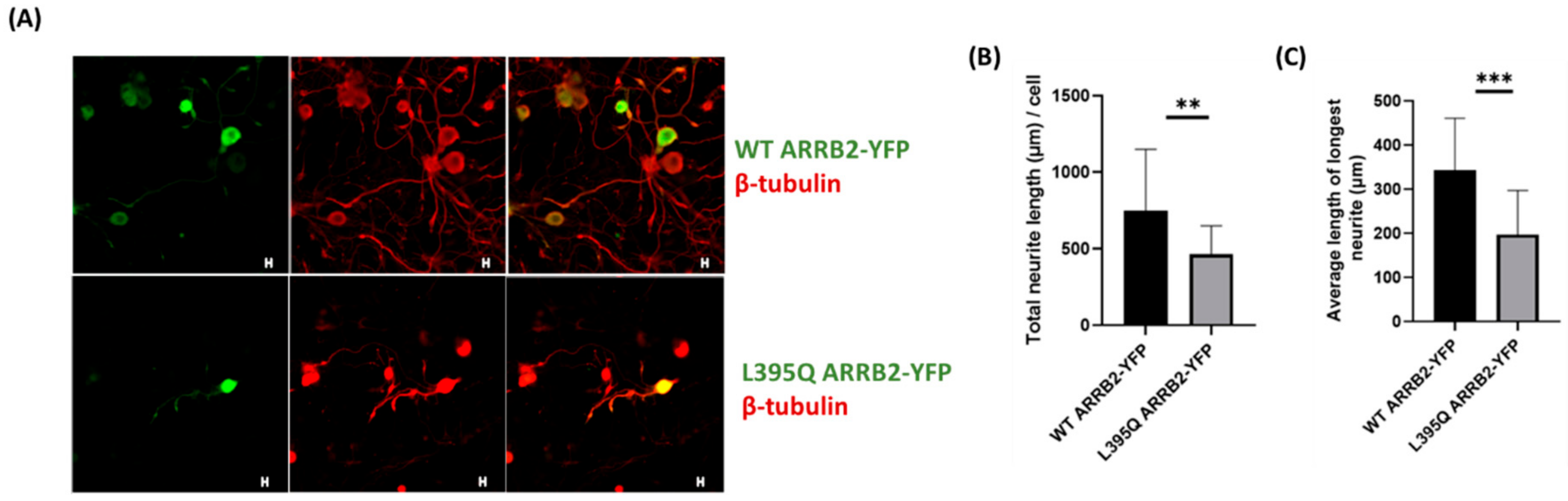 Ijms Free Full Text Trpv1 Activation Promotes B Arrestin2 Interaction With The Ribosomal Biogenesis Machinery In The Nucleolus Implications For P53 Regulation And Neurite Outgrowth Html