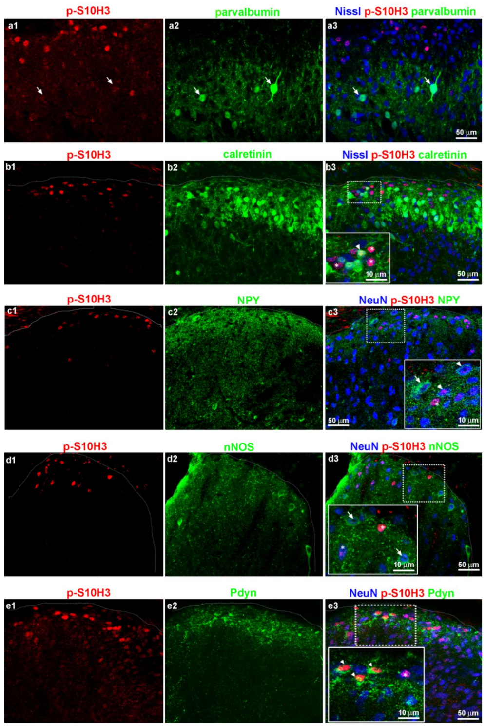 Ijms 22 02297 g007 Ijms 22 02297 g007