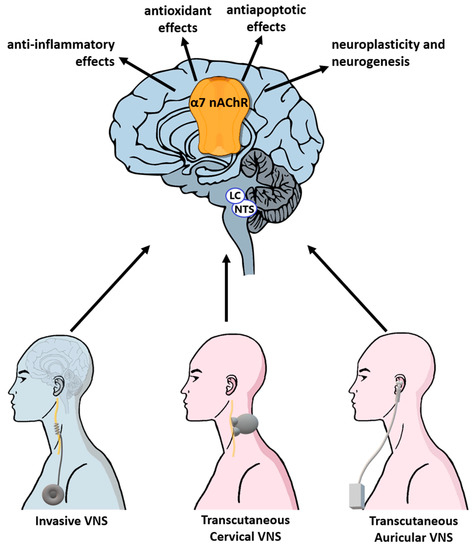 Targeting the Autonomic Nervous System for Risk Stratification, Outcome ...