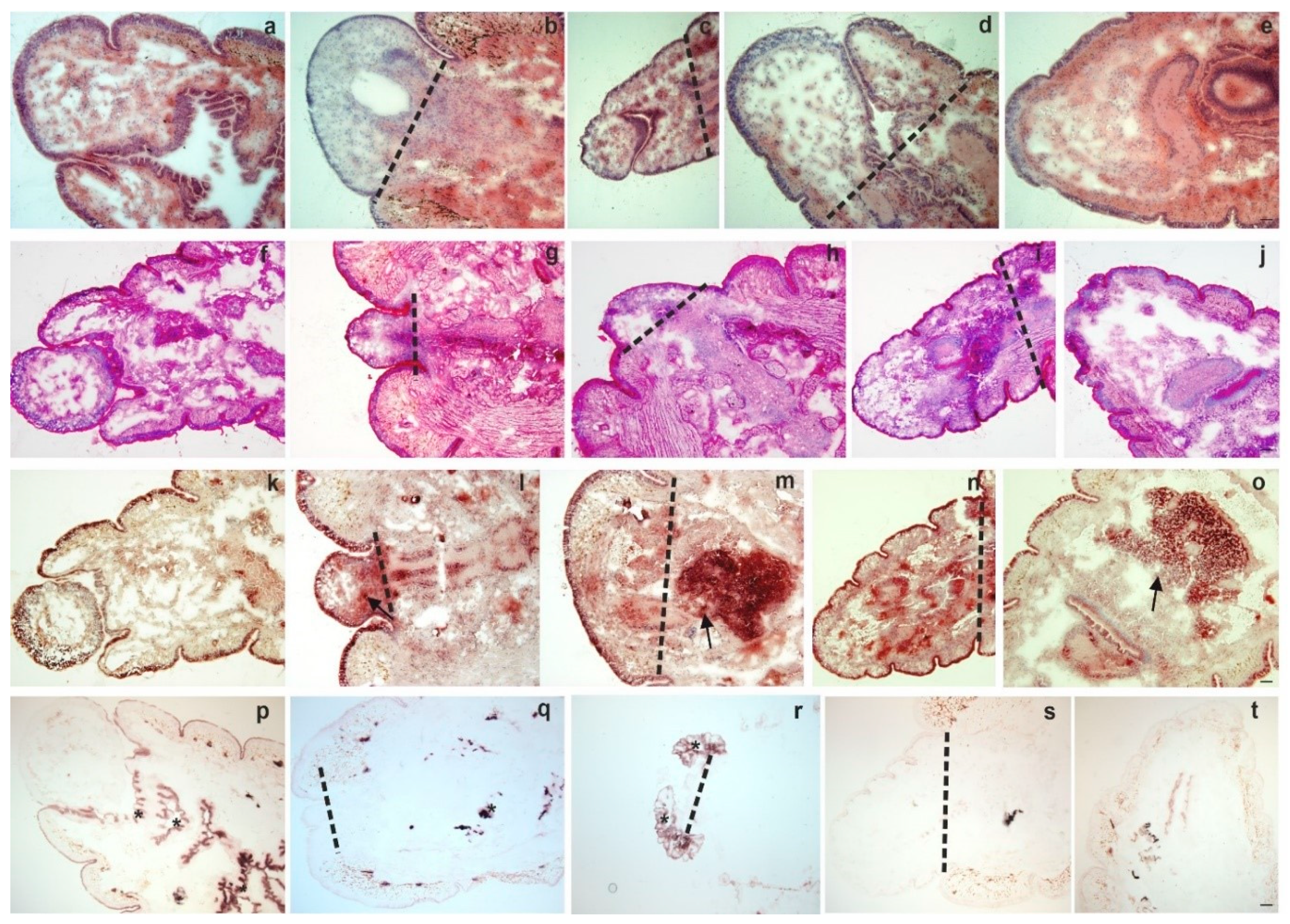 Ijms Free Full Text Injury Induced Innate Immune Response During Segment Regeneration Of The Earthworm Eisenia Andrei Html